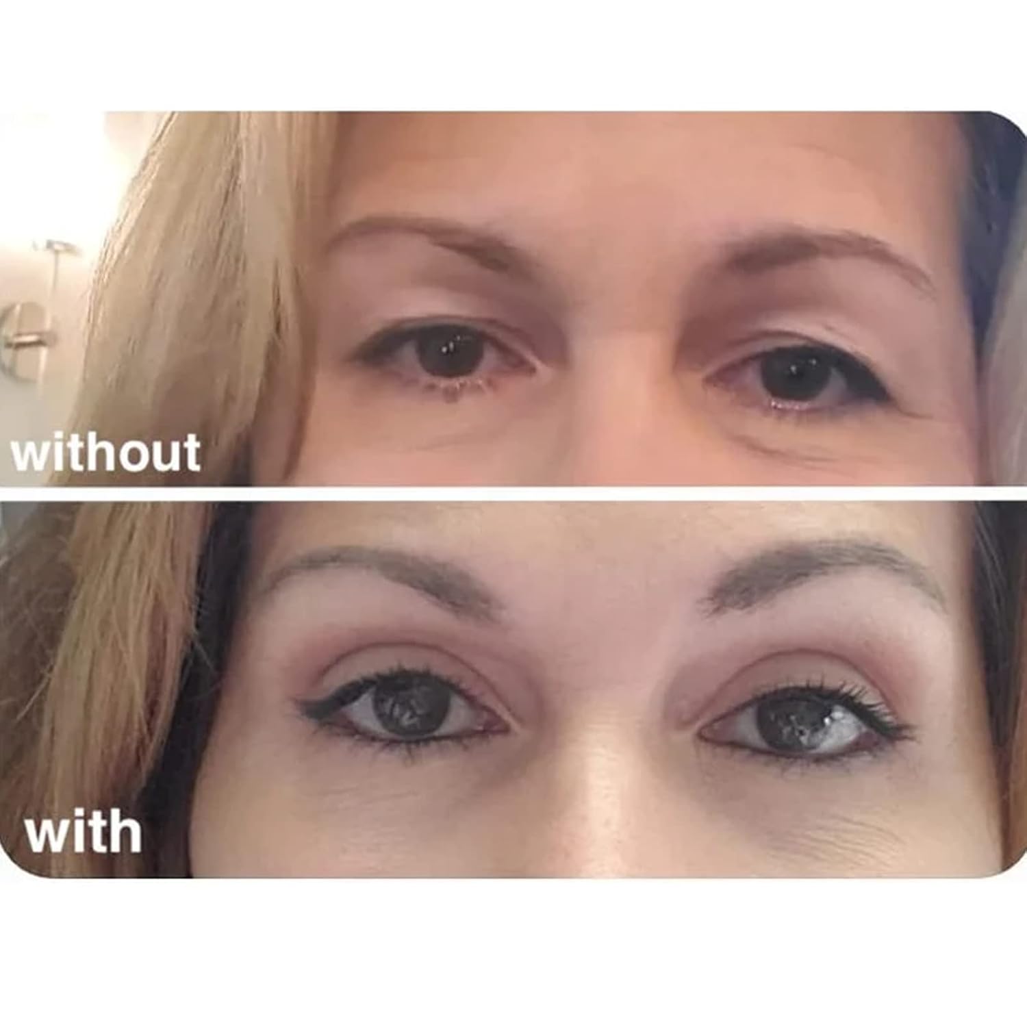 Geneve Tiras invisibles para levantamiento de ojos, tiras de levantamiento de ojos Genève, tiras invisibles de levantamiento de ojos, párpado