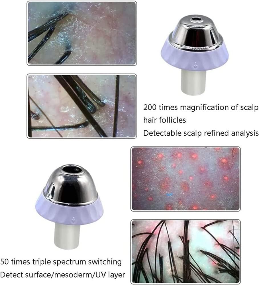 Analizador de pelo de piel, probador de cabello de 11 pulgadas, pantalla LCD HD, microscopio digital, analizador de diagnóstico de piel con 50 x 200