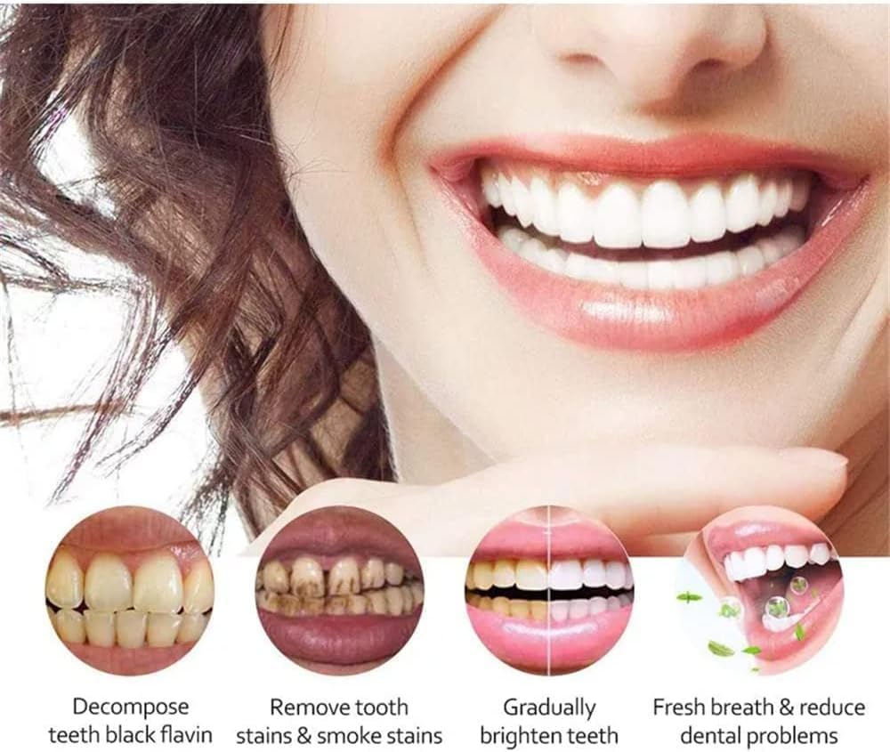 Pasta de dientes blanqueadora SP-4 Probióticos, pasta de dientes Yayashi SP-4, pasta de dientes de aliento fresco, promueve dientes y encías