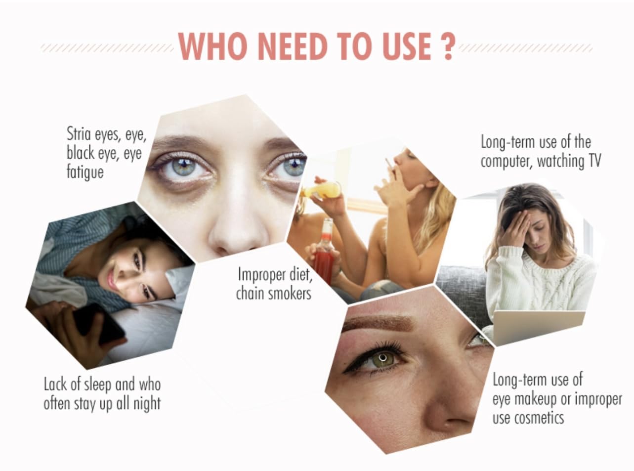 Parches para debajo de los ojos (30 unidades)  Rosa, dorado, hidrogel para debajo de los ojos, aminoácido y colágeno, máscara debajo de los ojos