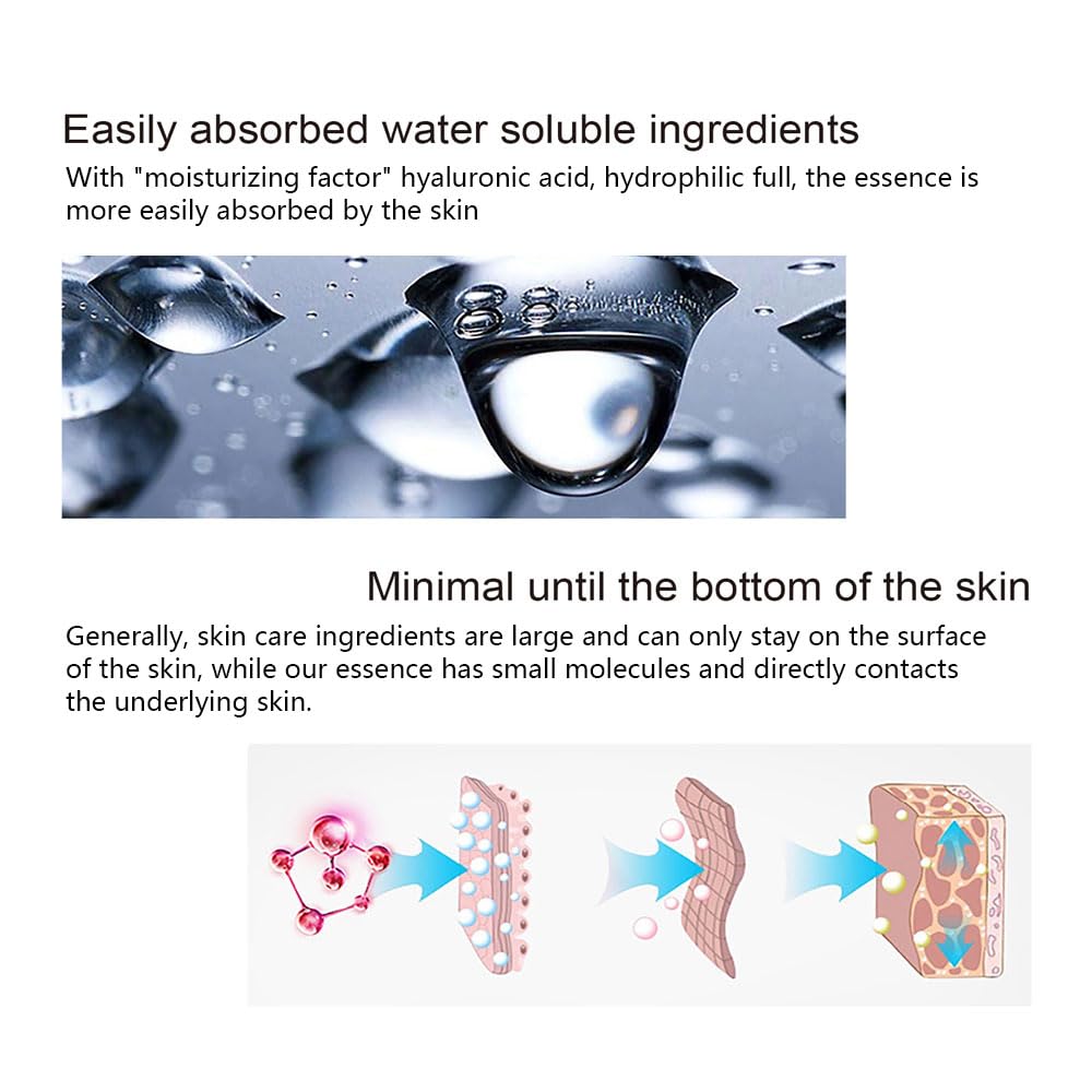 Suero facial de niacinamida para cara y piel, suero facial hidratante para acné, manchas oscuras, poros, líneas finas