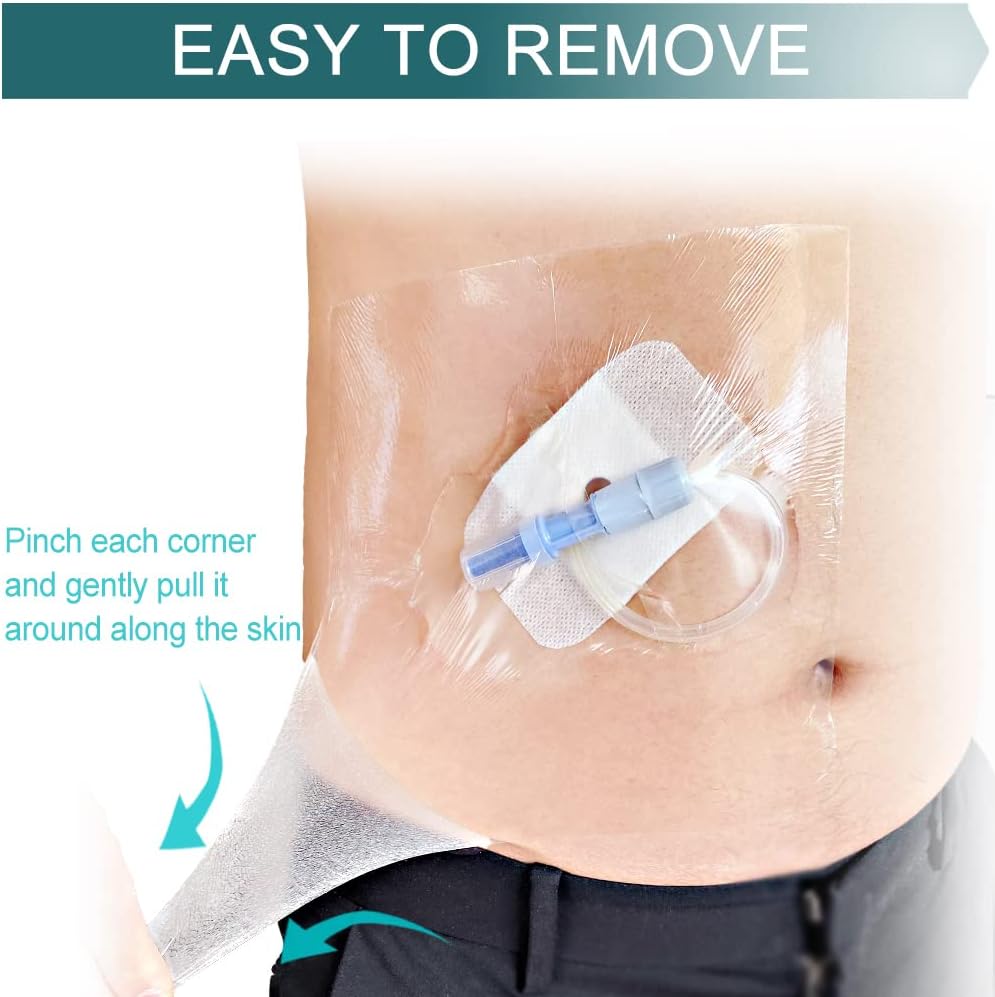 Vendajes de incisión impermeables posquirúrgicos para vendaje de heridas grandes, parche adhesivo transparente para diálisis PICC, puerto de pecho,