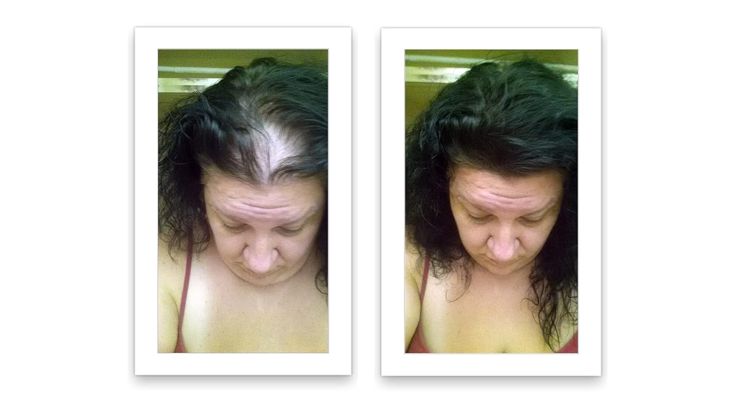 Oculta puntos calvos y bordes calvos al instante. Haz que el cabello fino se vea 10 veces más lleno. Kit de inicio de fibra capilar Caboki (negro)