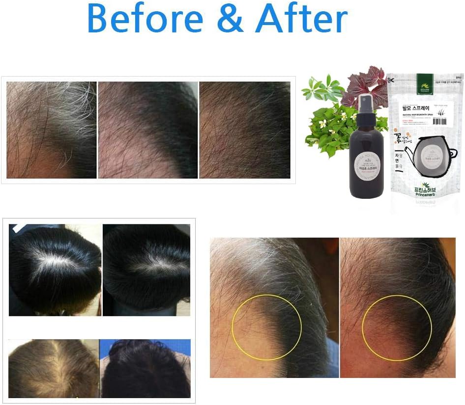 Juego de spray de tratamiento herbario 100% natural y juego de té para ayudar a la regeneración del cabellospray de restauración del cabello y juego