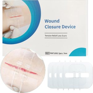 4 piezas de costuras con cierre de heridas, eficientes vendas adhesivas de emergencia para primeros auxilios y cuidado de heridas, 2.4 x 2.8 4 piezas de costuras con cierre de heridas, eficientes vendas adhesivas de emergencia para primeros auxilios y cuidado de heridas, 2.4 x 2.8