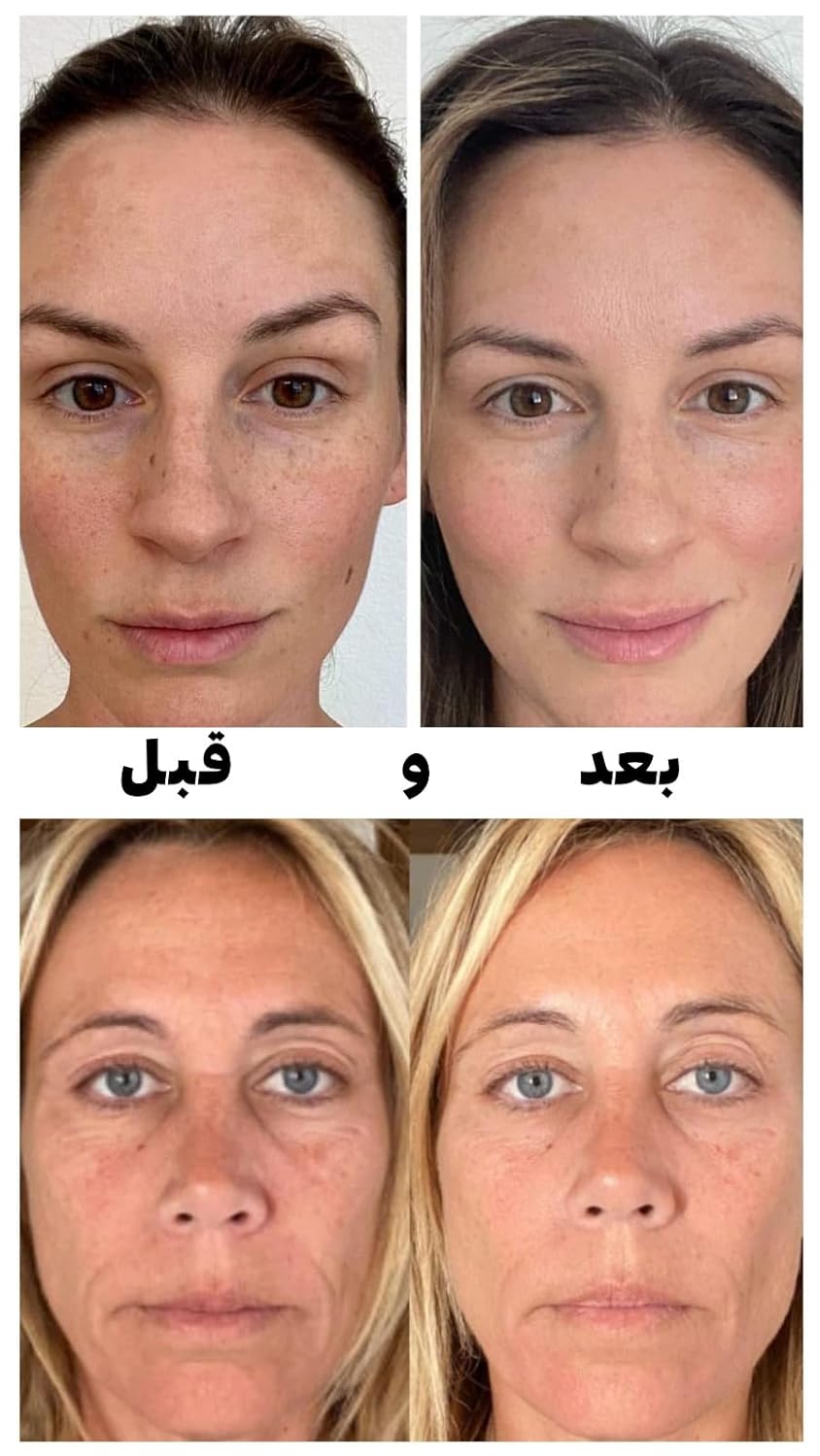 Spray facial de 3.4 onzas líquidas (nano-formulado) con glutatión, colágeno y ácido hialurónico, cuidado facial y firme, espray facial minimizador