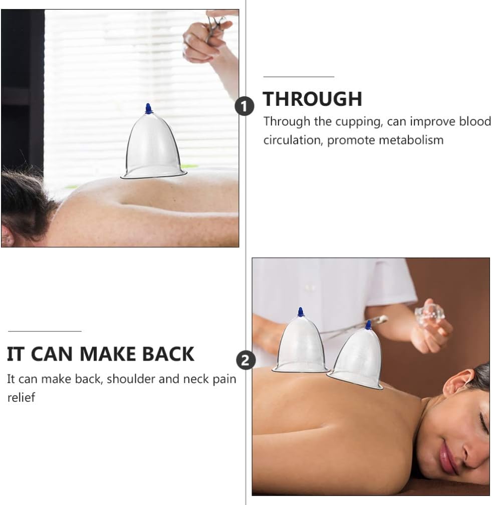 Dispositivo de terapia de ventosas al vacío de presión negativa, conjunto de ventosas al vacío, conjunto de ventosas para el cuerpo, cuerpo de