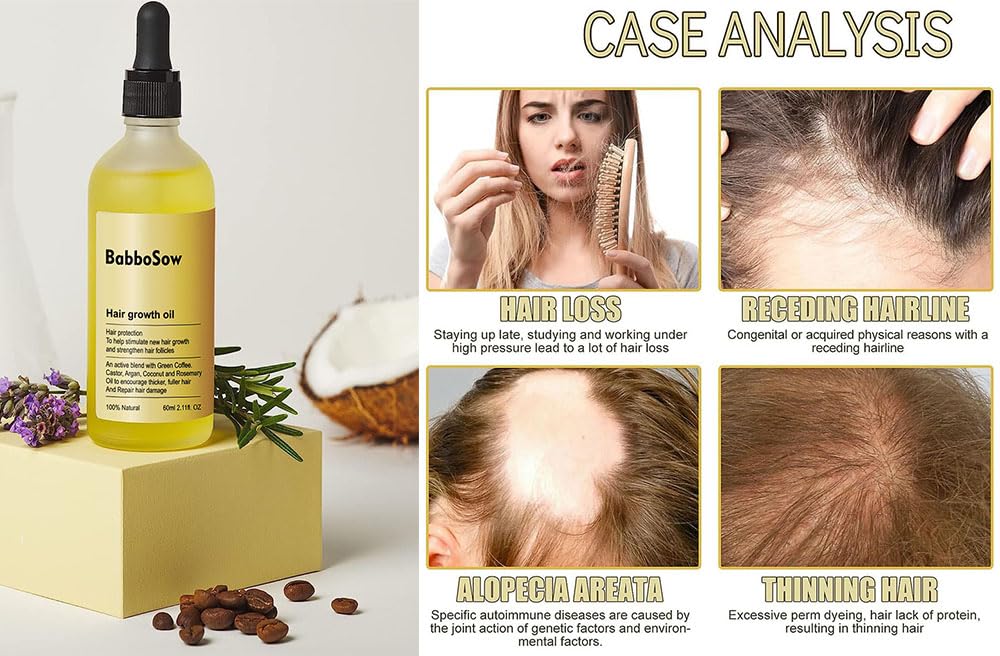 Veganic Aceite Natural para el Crecimiento del Cabello,Aceite Vegánico para el Crecimiento del Cabello,Aceite de Romero para el Crecimiento del