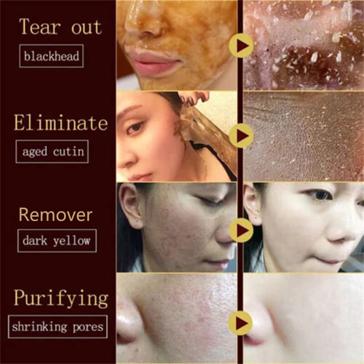 Máscara facial rasgante de miel, control de aceite, sin dolor, espinillas y piel muerta, mascarilla facial de 24 unidades, máscara de miel para