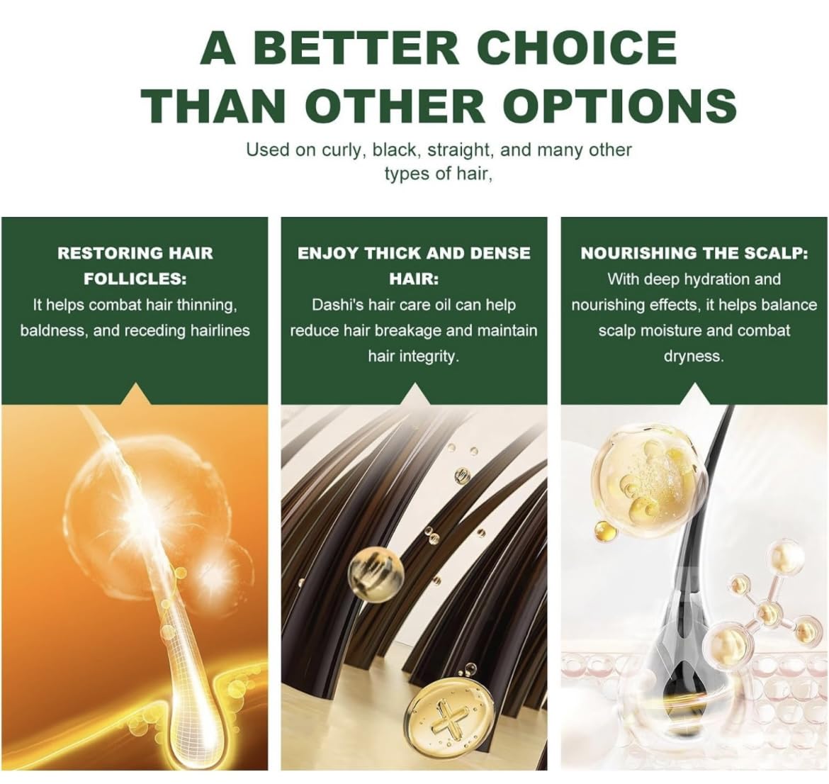 Dash Aceite de crecimiento del cabello, aceite de romero avanzado para el crecimiento del cabello, mezcla única de aceite capilar para cabello seco