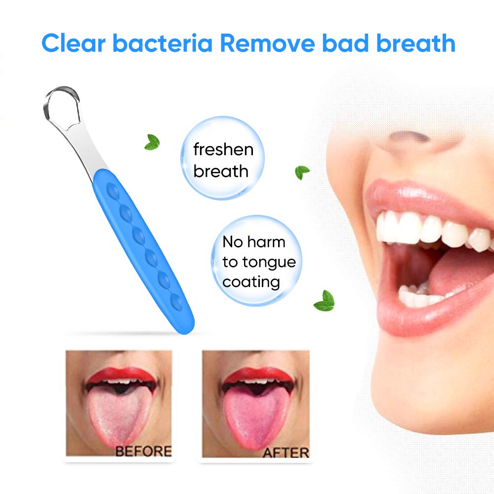 Nueva versión limpiador raspador de lengua para adultos y niños, juego de cepillos de lengua de metal de grado médico para aliento fresco dental
