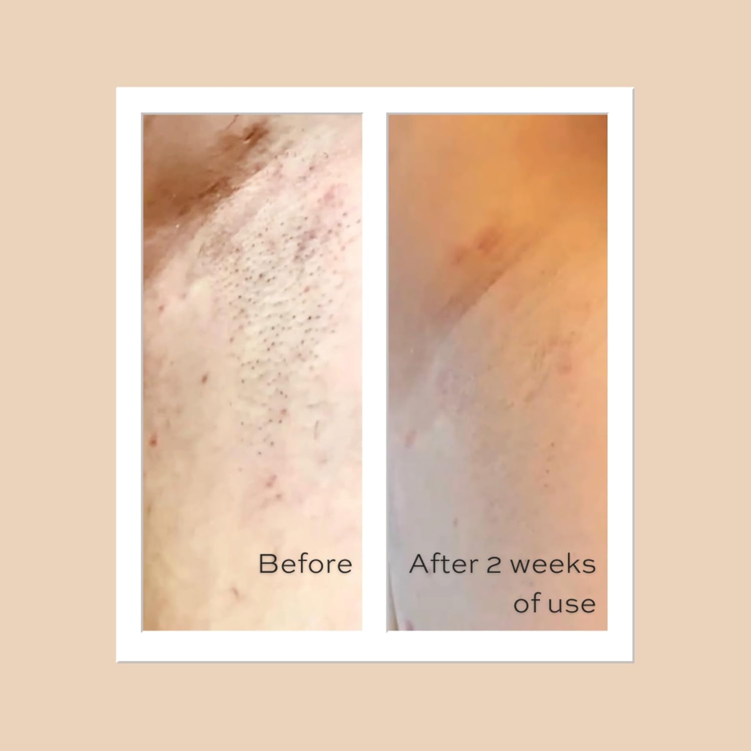Jabón exfoliante de arándanos y rituales diarios de avena privada de 3.25 oz  92 g  Gel de baño para manchas oscuras, zonas íntimas, axilas  Juego