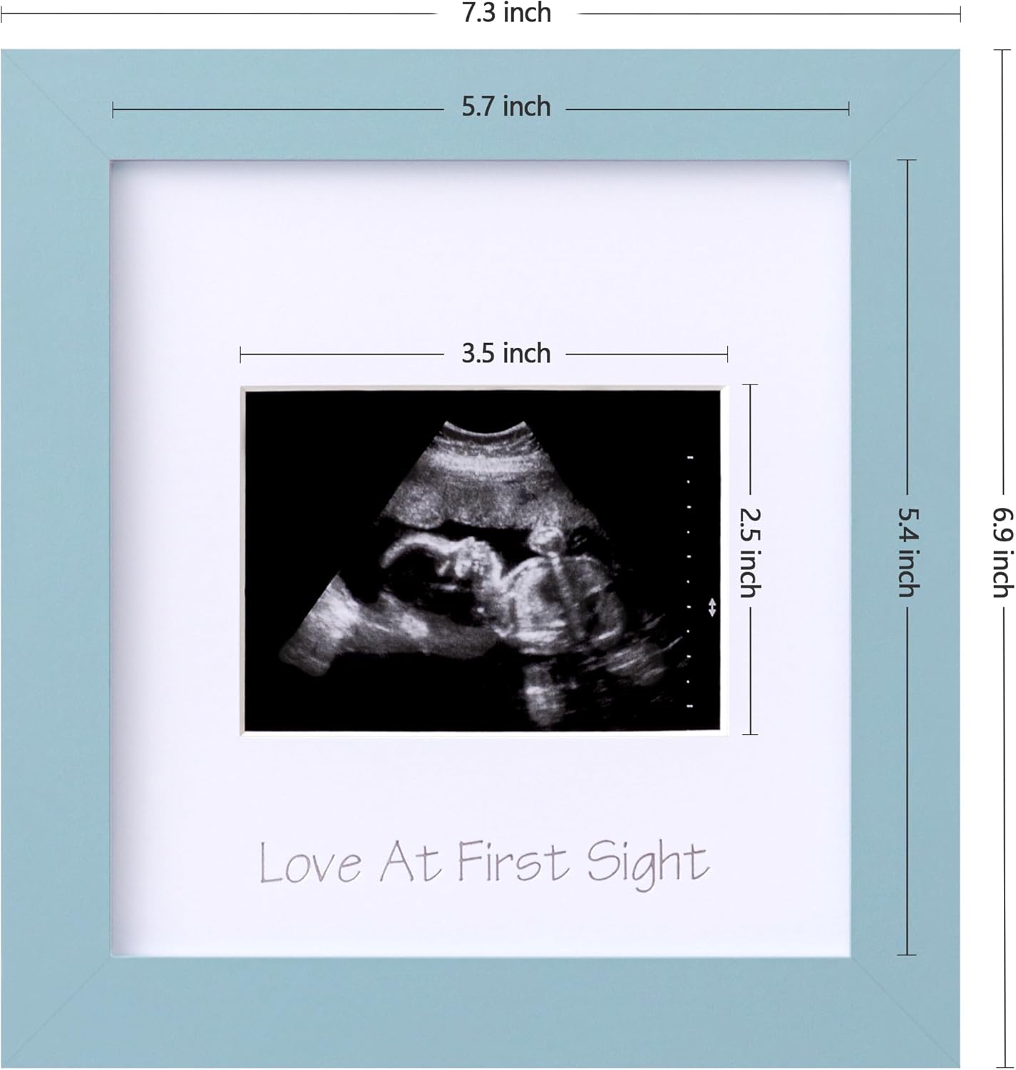 eletecpro Sonogram – Portarretratos con ultrasonido de 3 x 4, marcos de fotos de ultrasonido para anuncio de embarazo, regalos únicos para mujeres