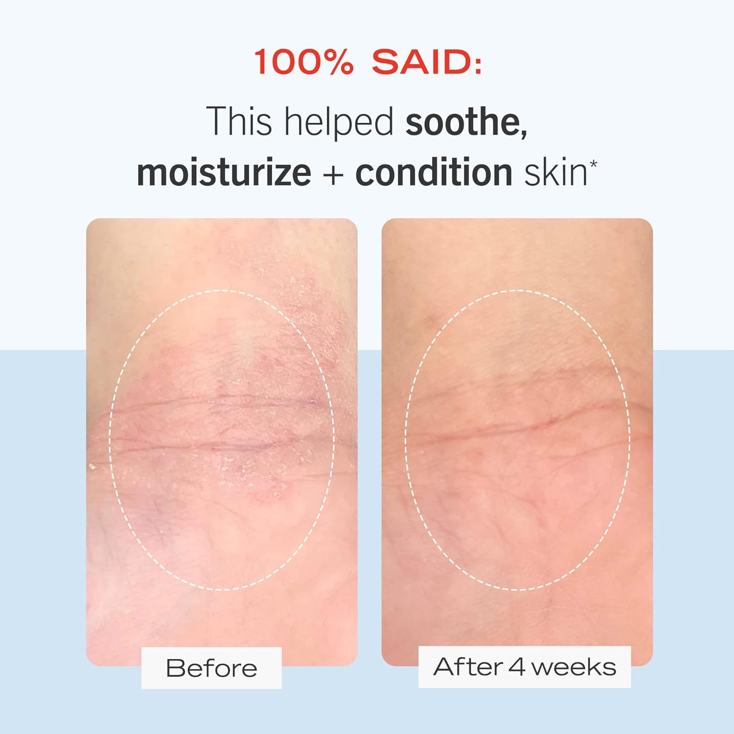 First Aid Beauty Ultra Repair Cream Hidratante Intensa Hidratante para Cara y Cuerpo – 12 oz.
