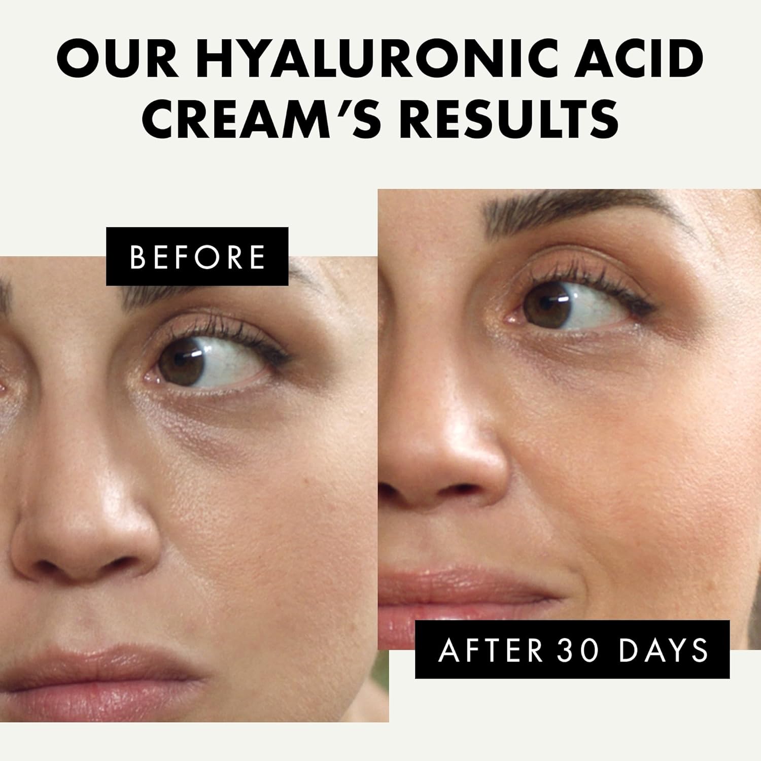 Hidratante facial de ácido hialurónico para mujeres y hombres, loción facial antienvejecimiento, crema facial hidratante antiarrugas, crema