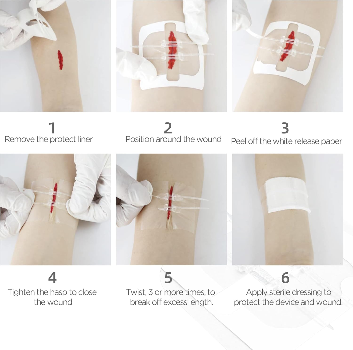 LotFancy Cierres de heridas de emergencia, 4 unidades, suministros de primeros auxilios, vendas médicas de mariposa, kit de reparación de laceración