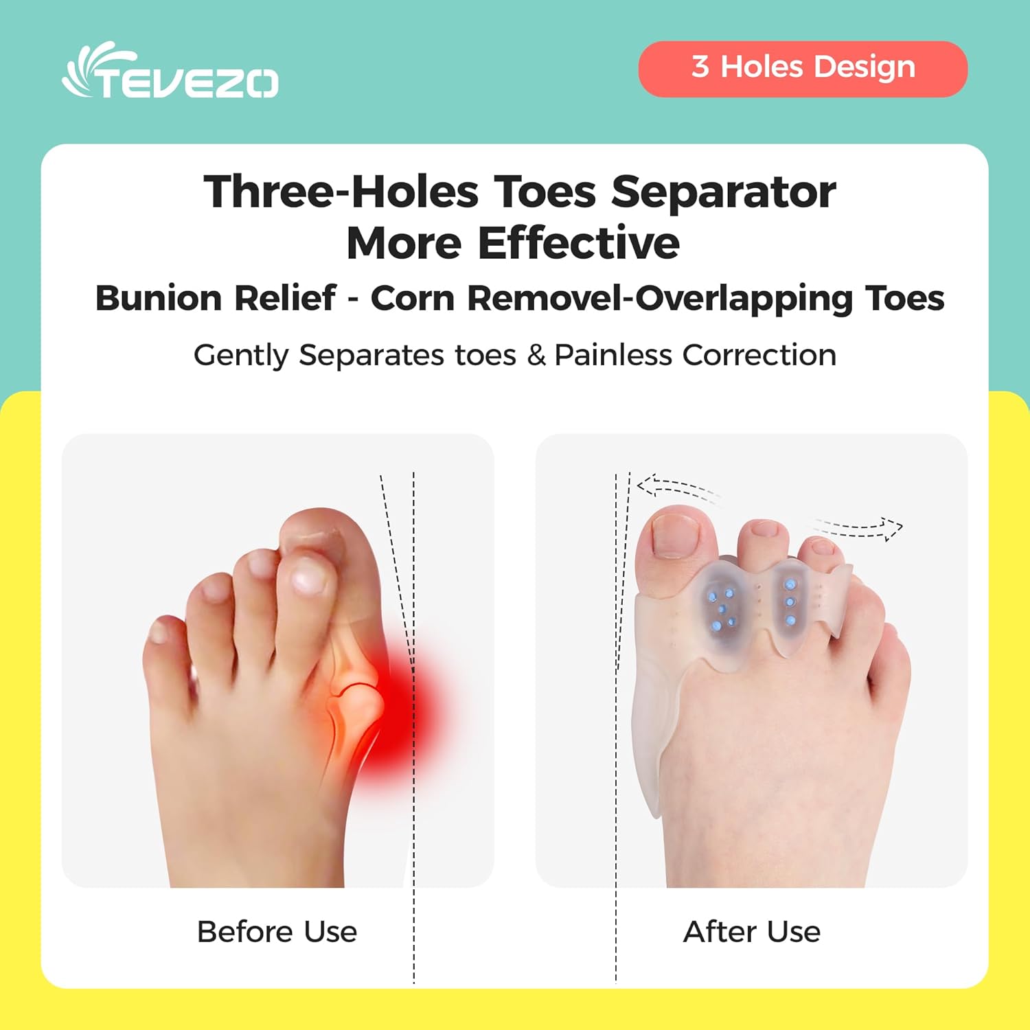 Tevezo Separadores de dedos y corrector de juanetes para hombres y mujeres, separadores de dedos, eliminadores de callos de maíz, enderezadora de