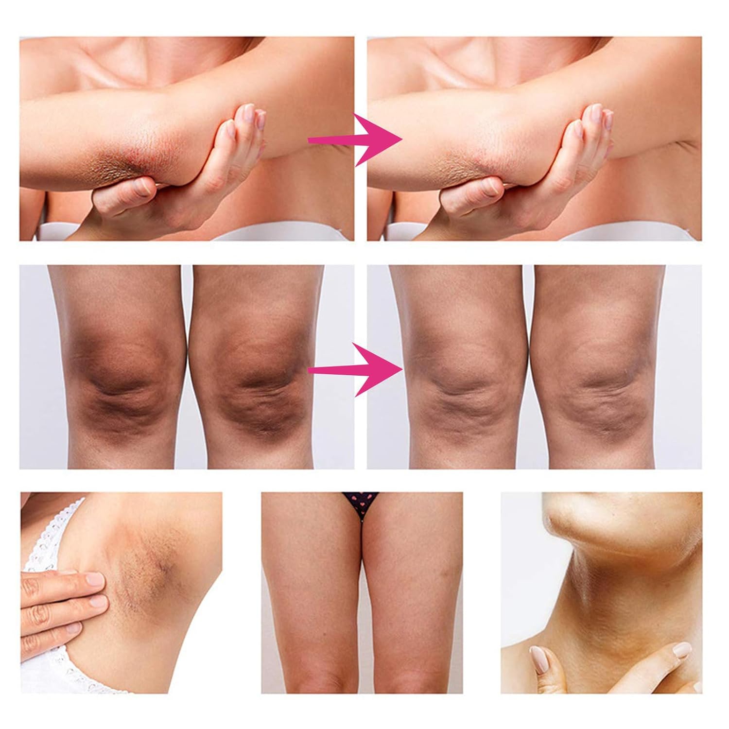 Crema Blanqueadora para Partes Intimas, Crema para Las Manchas de La Cara, Crema para Aclarar las Axilas Y Partes Intimas, Leche Con Colageno Crema