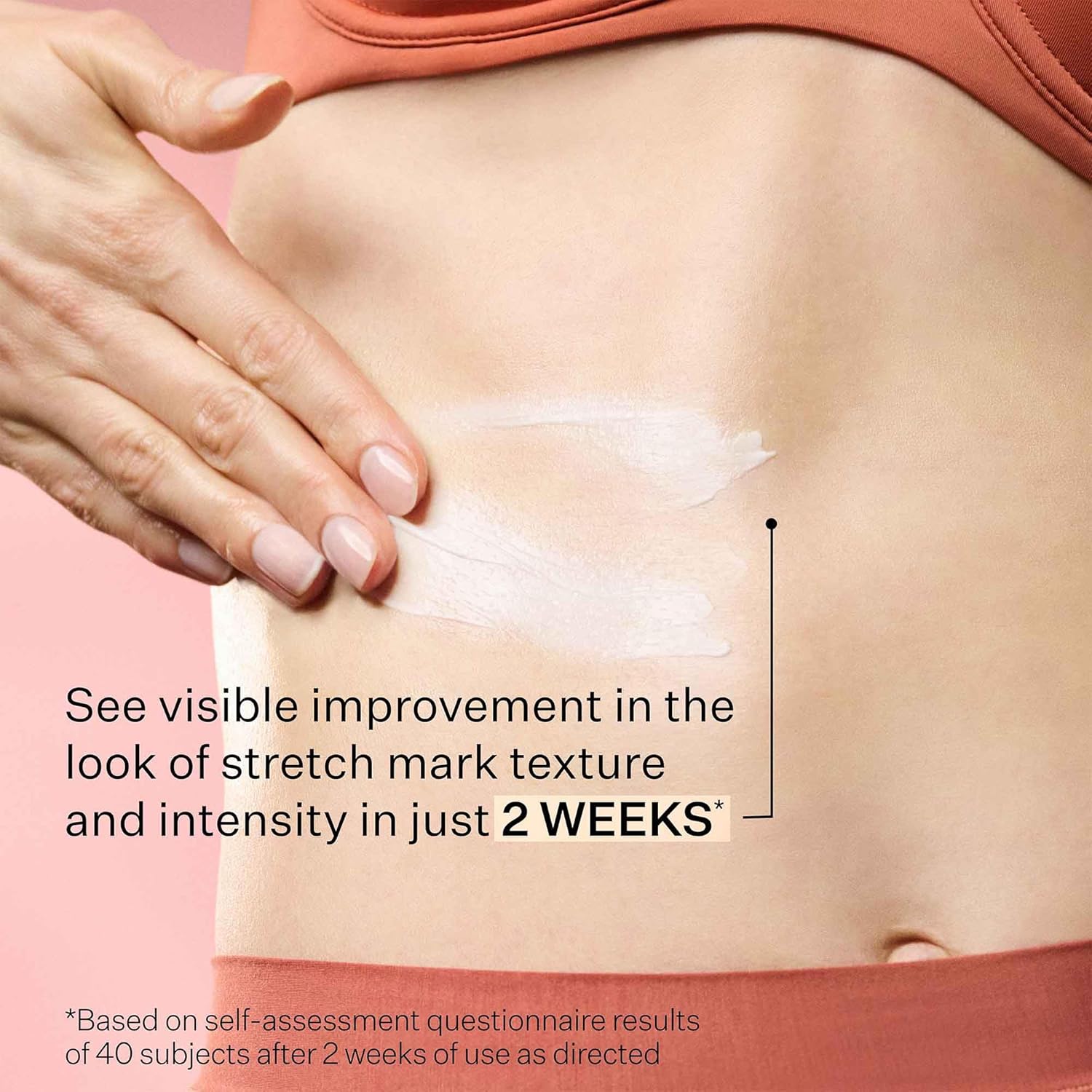 StriVectin SD Advanced Plus – Hidratante intensivo para arrugas y estrías, para rostro y cuerpo, estimulante de colágeno con péptidos y ácido