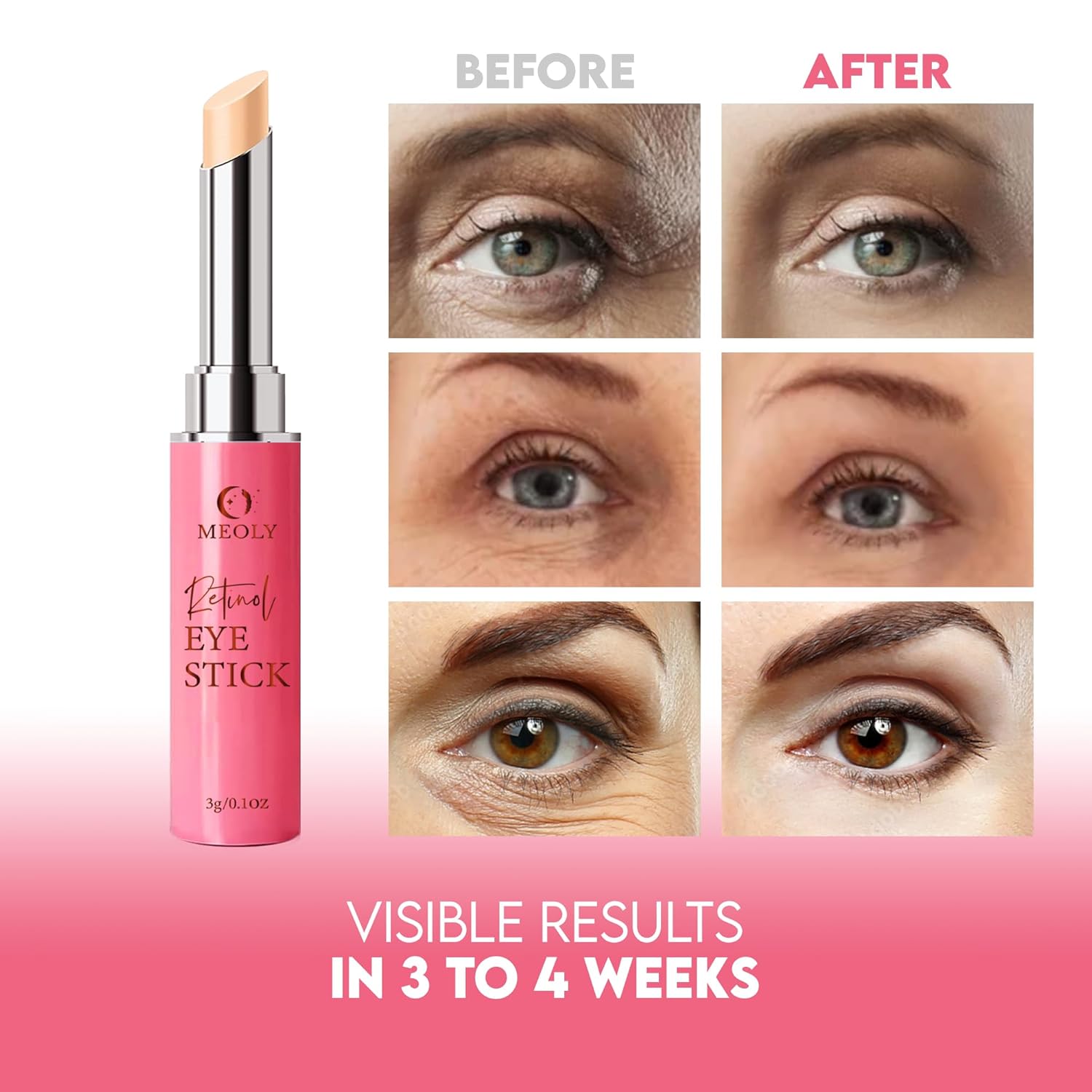 Removedor instantáneo de bolsas de ojos, crema de ojos de retinol para ojeras, barra iluminadora debajo de los ojos, crema antienvejecimiento, crema