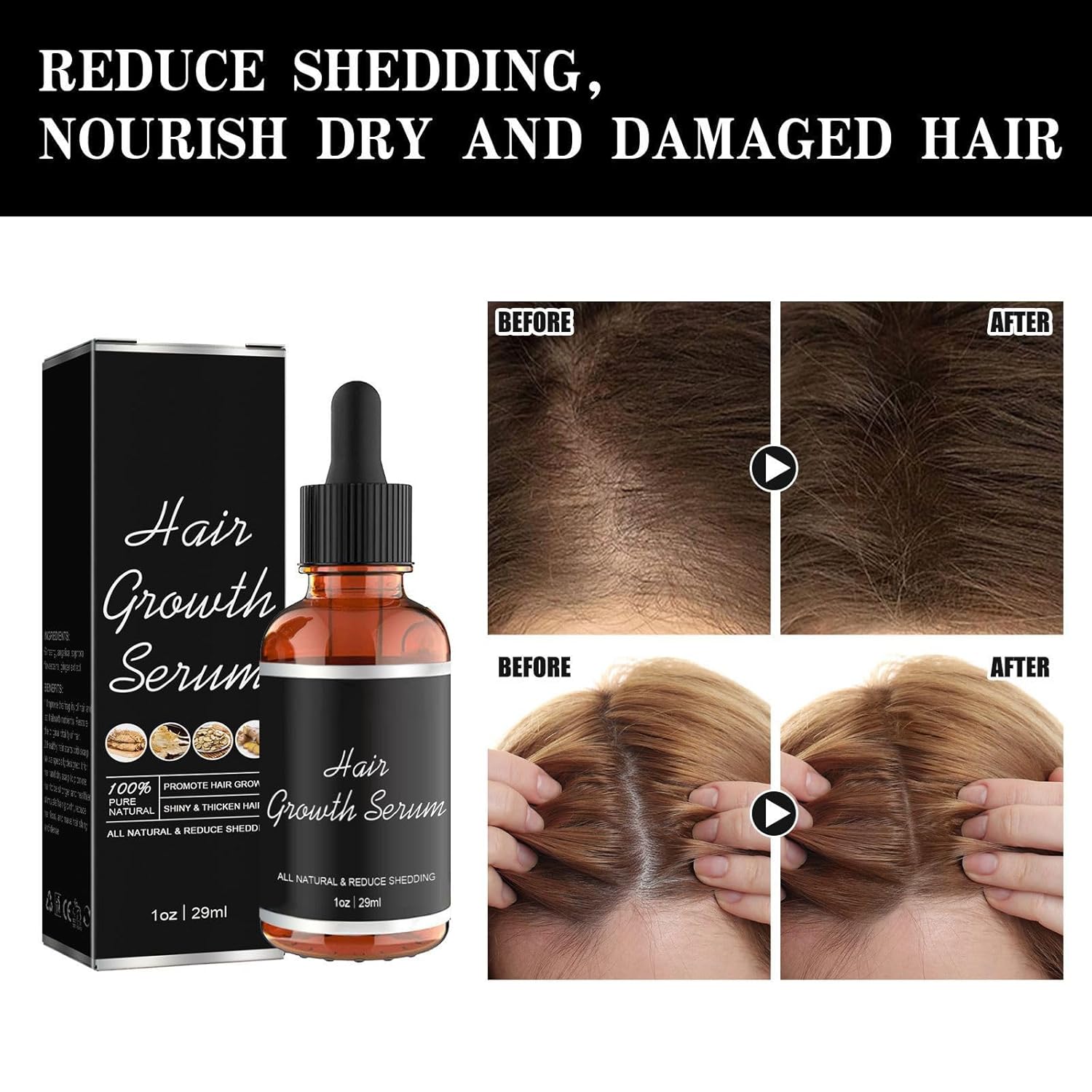 Noor – Suero para el crecimiento del cabello, aceitunas africanas, aceite de crecimiento del cabello para la pérdida del cabello, suero de