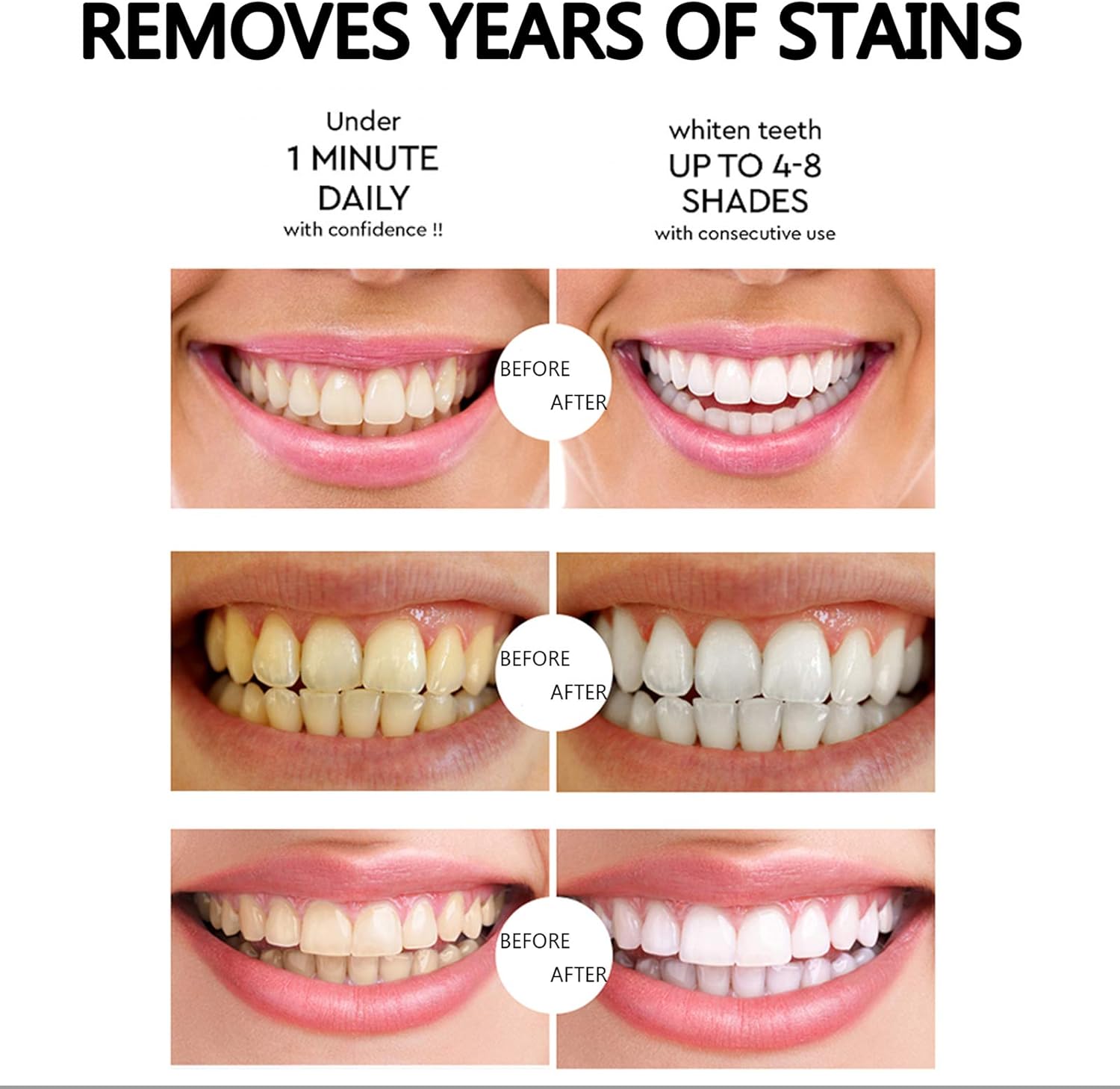 Bolígrafos blanqueadores de dientes, paquete de 3 bolígrafos de gel para blanquear los dientes, paquete de 3 bolígrafos de gel desensibilizante, 1