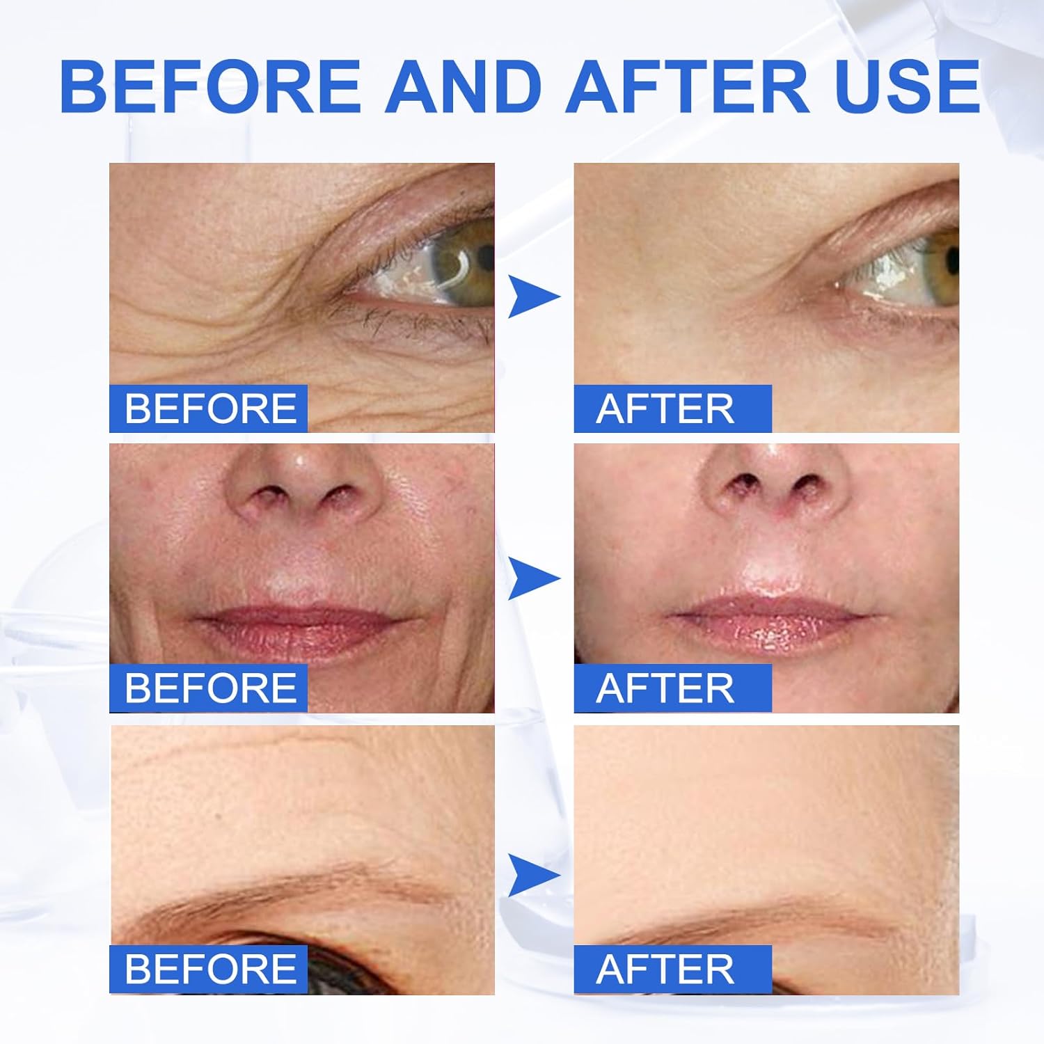 Botox Stock Solution – Suero facial Botox de 1.0 fl oz con vitamina C, Botox en una botella de ajuste facial instantáneo, suero antienvejecimiento