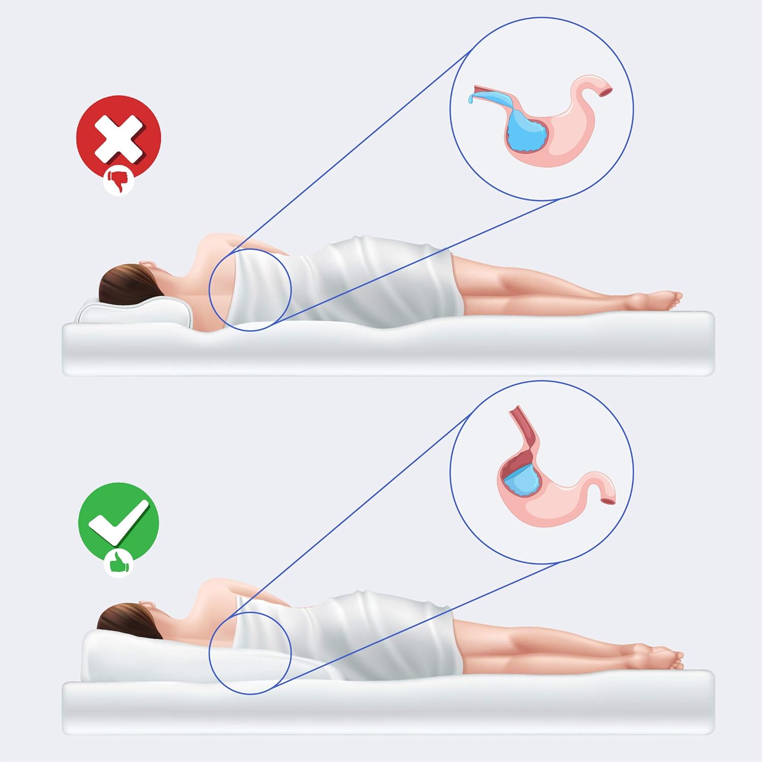 Back Support Systems Cuña de cama para reflujo ácido. Espuma viscoelástica de alta calidad de una pulgada. Ayuda a aliviar la ERGE, la circulación y