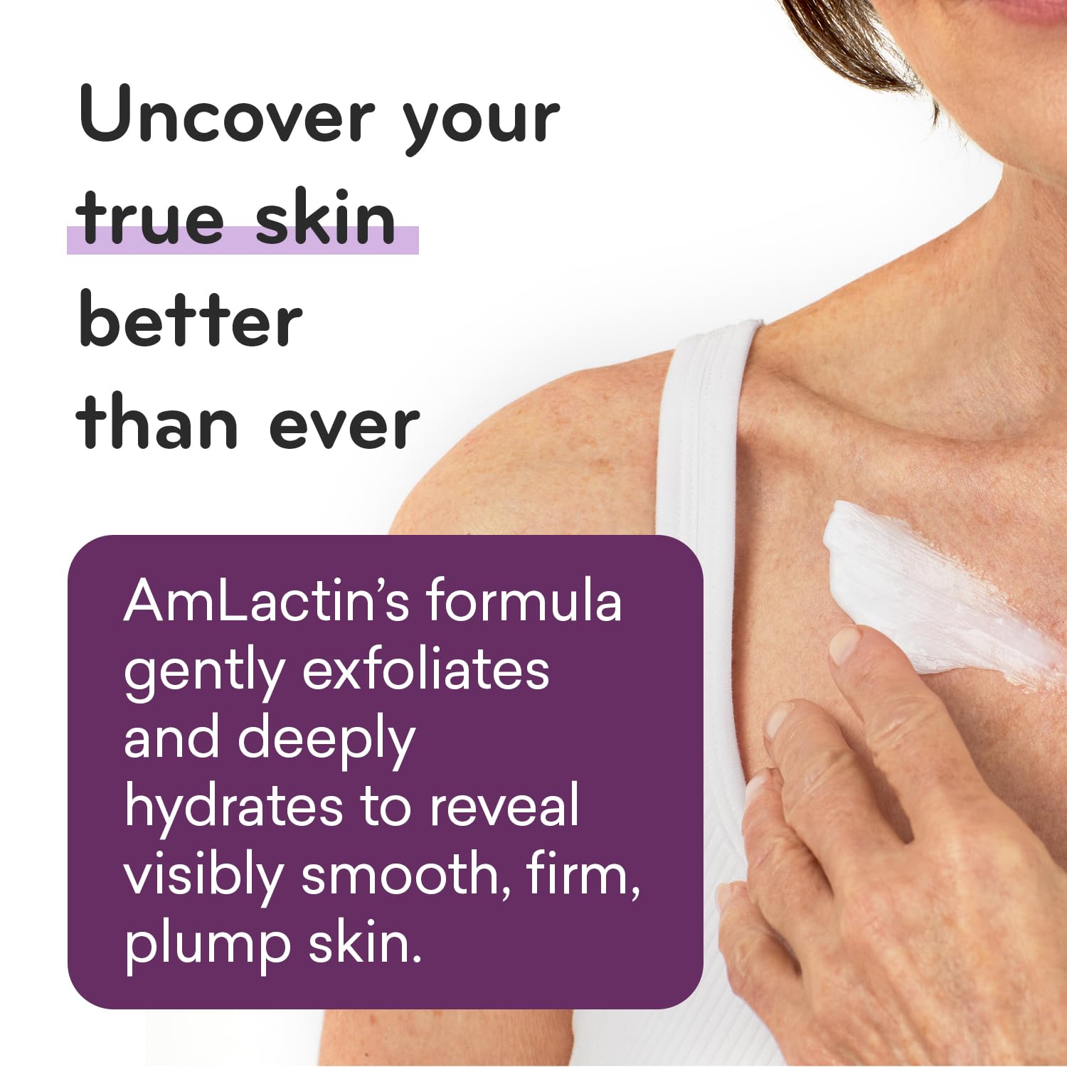 AmLactin Crema reafirmante de crepé, crema corporal de 12 onzas con 15% de ácido láctico, exfoliante e hidratante para crepey, piel seca y ultra