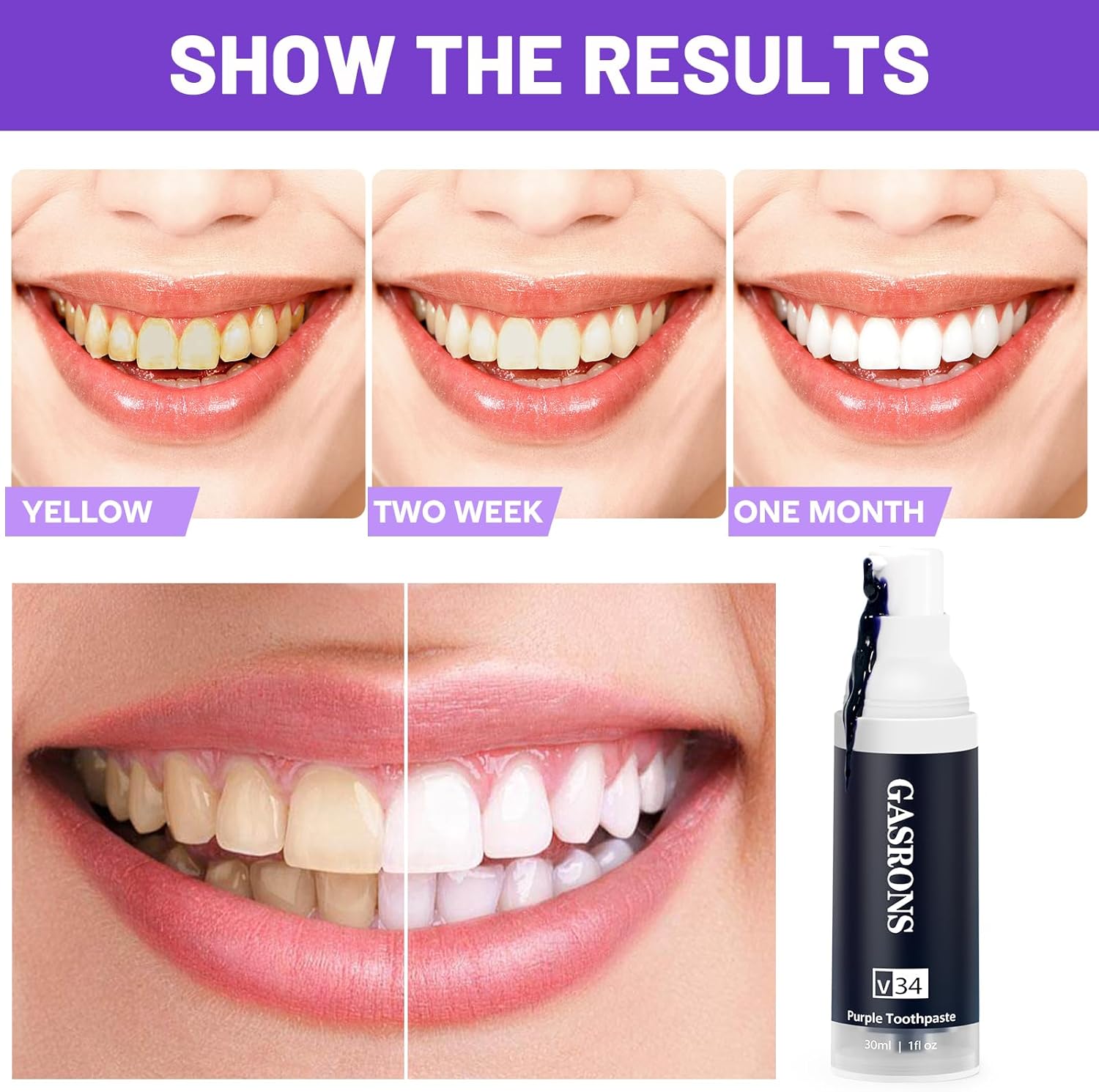 Pasta de dientes morada, Blanqueamiento de dientes púrpura, Eliminación de manchas de dientes, Retiro de Blanqueamiento de Dientes, Potenciador de
