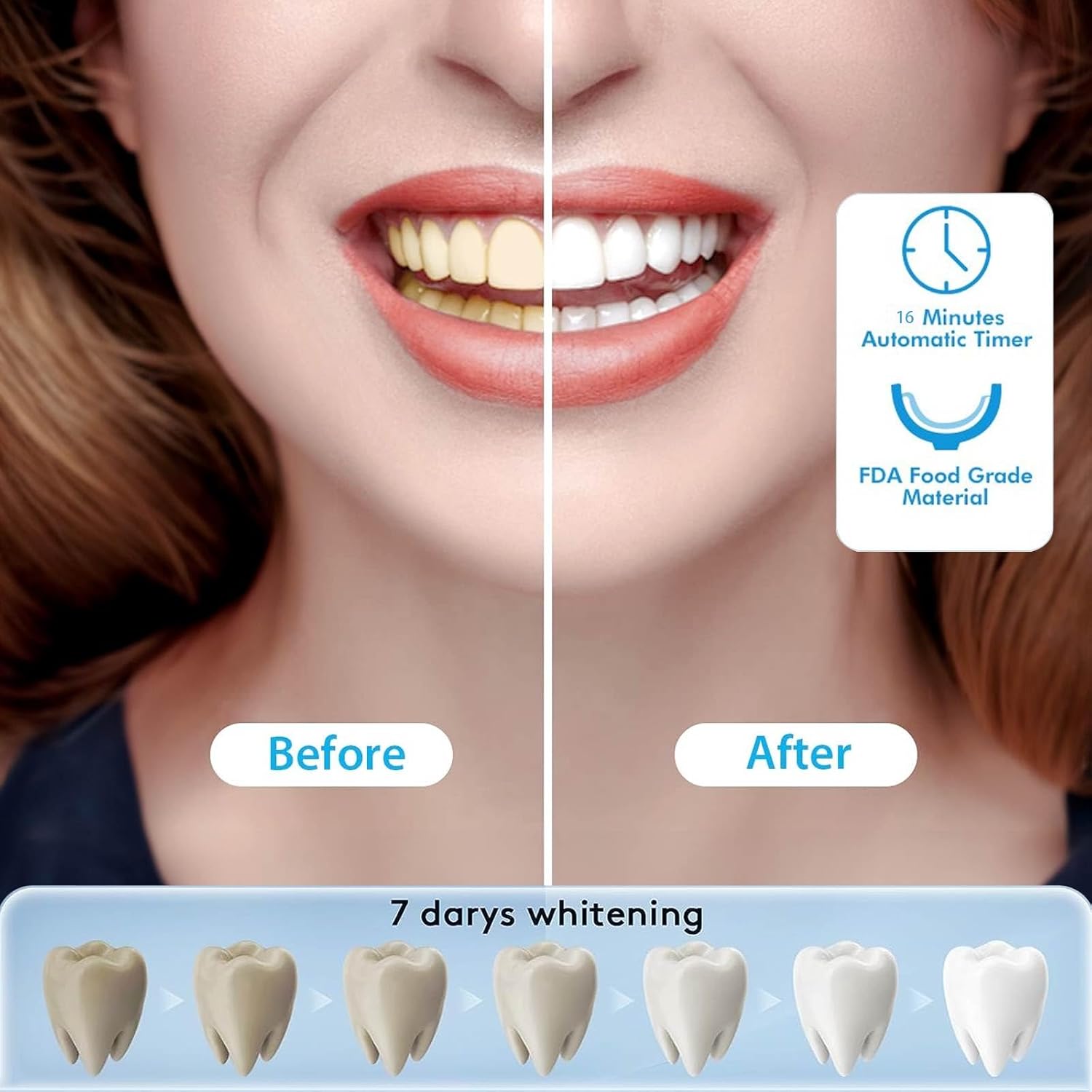 Kit de blanqueamiento dental con bandeja de blanqueamiento de dientes, luz LED inalámbrica, 16 minutos para blanquear los dientes, gel blanqueador
