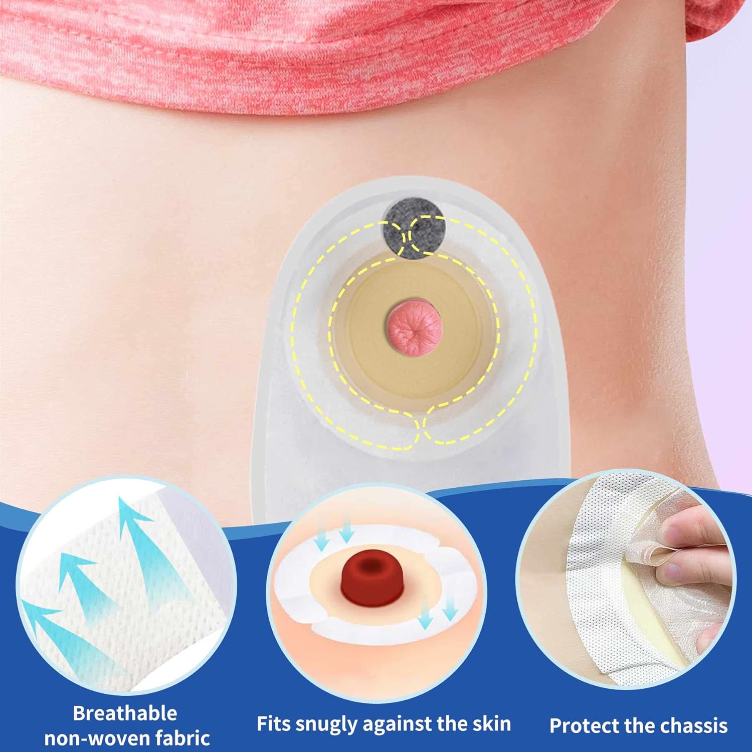 Tiras de barrera para ostomía, suministros de ostomía, tira elástica de barrera para la piel, extensores de cinta de barrera para ostomía para