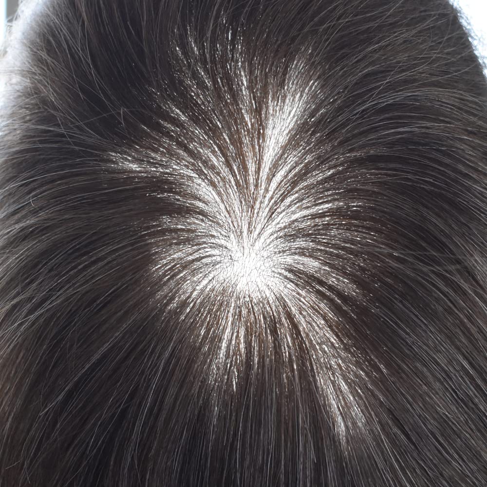 Healthlif Toupee para hombres Pieza de pelo ultrafina para piel Toupee Men Sistema de cabello humano con bucle en V para hombres Unidad de cabello