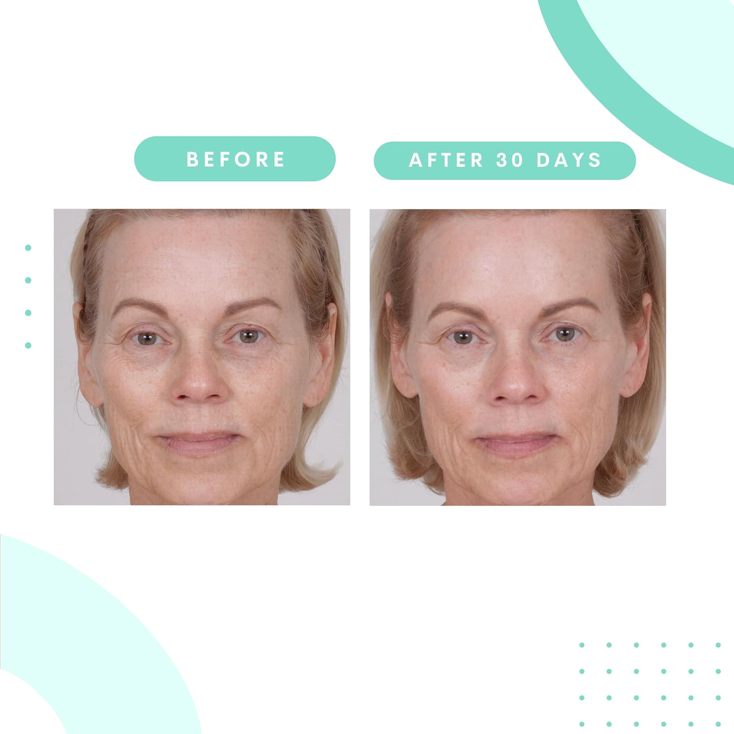Serious Skincare – Almohadillas faciales de rejuvenecimiento glicólico para una piel más suave – Ácido glicólico – Exfolia las células muertas de la