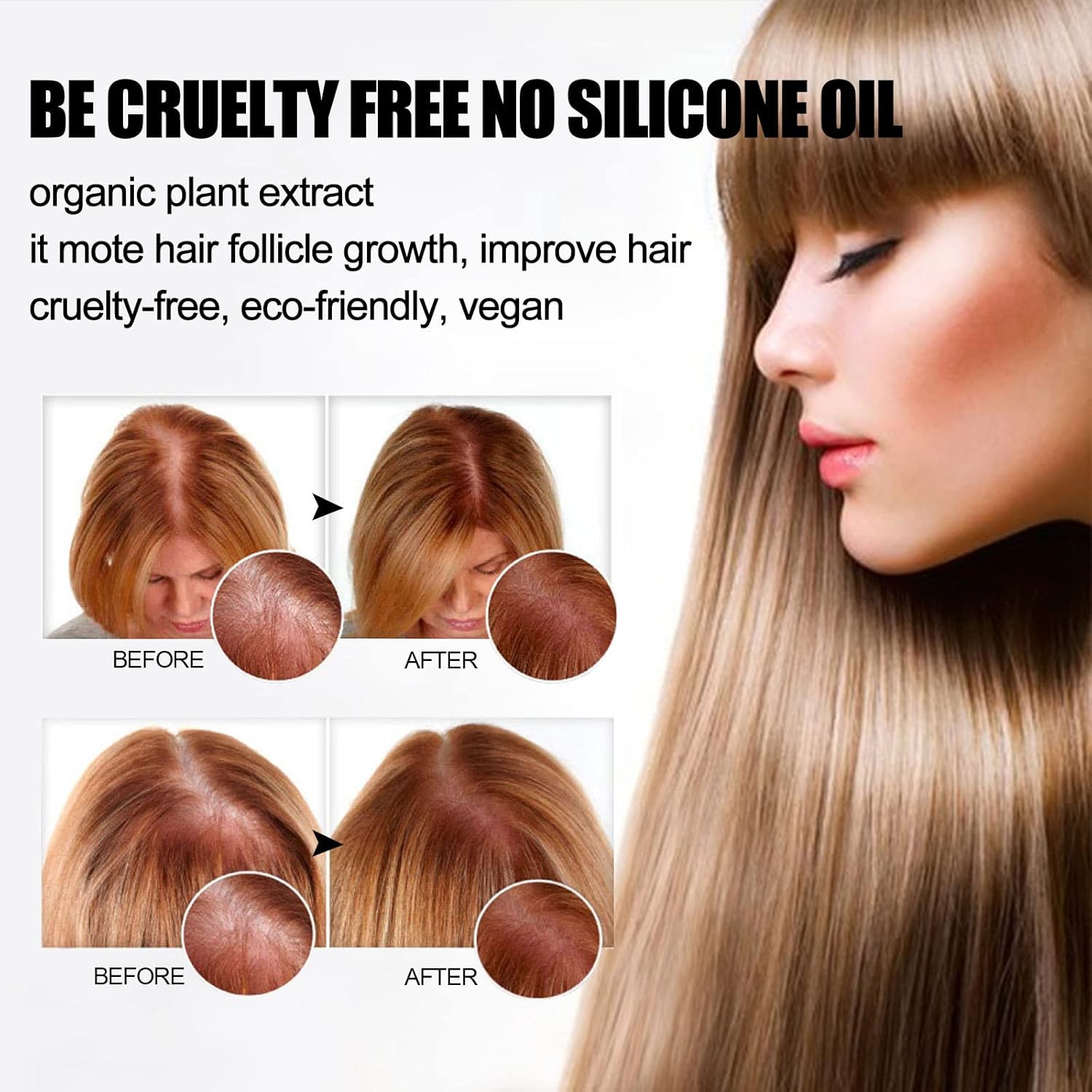 2 barras de champú de crecimiento de cabello de jengibre, jabón orgánico natural de jengibre para el cabello, promueve el crecimiento del cabello,