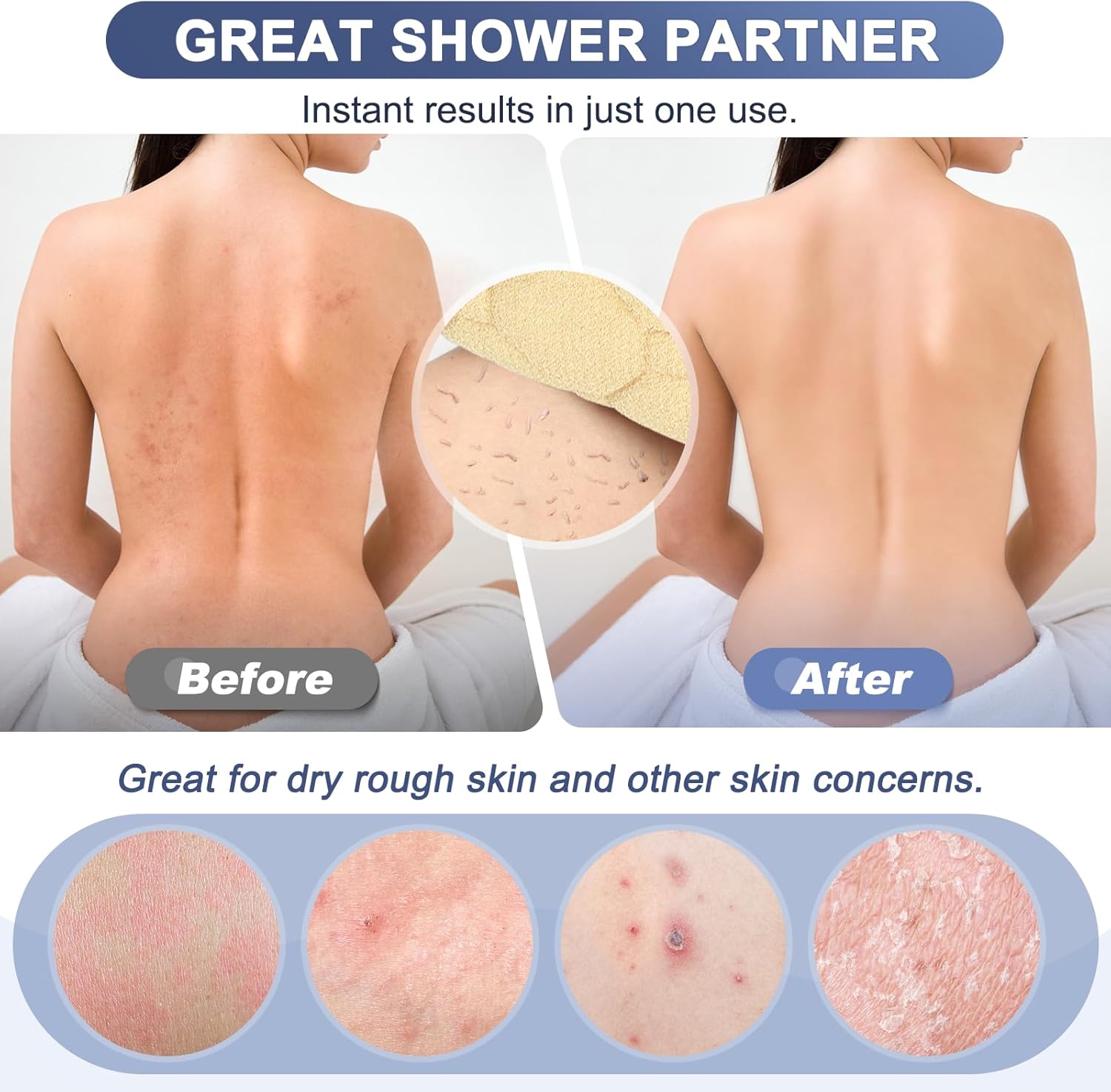 Exfoliante de espalda con asas, toalla exfoliante de espalda de doble cara de 39 pulgadas, toalla de baño exfoliante para uso en la ducha, lavadora