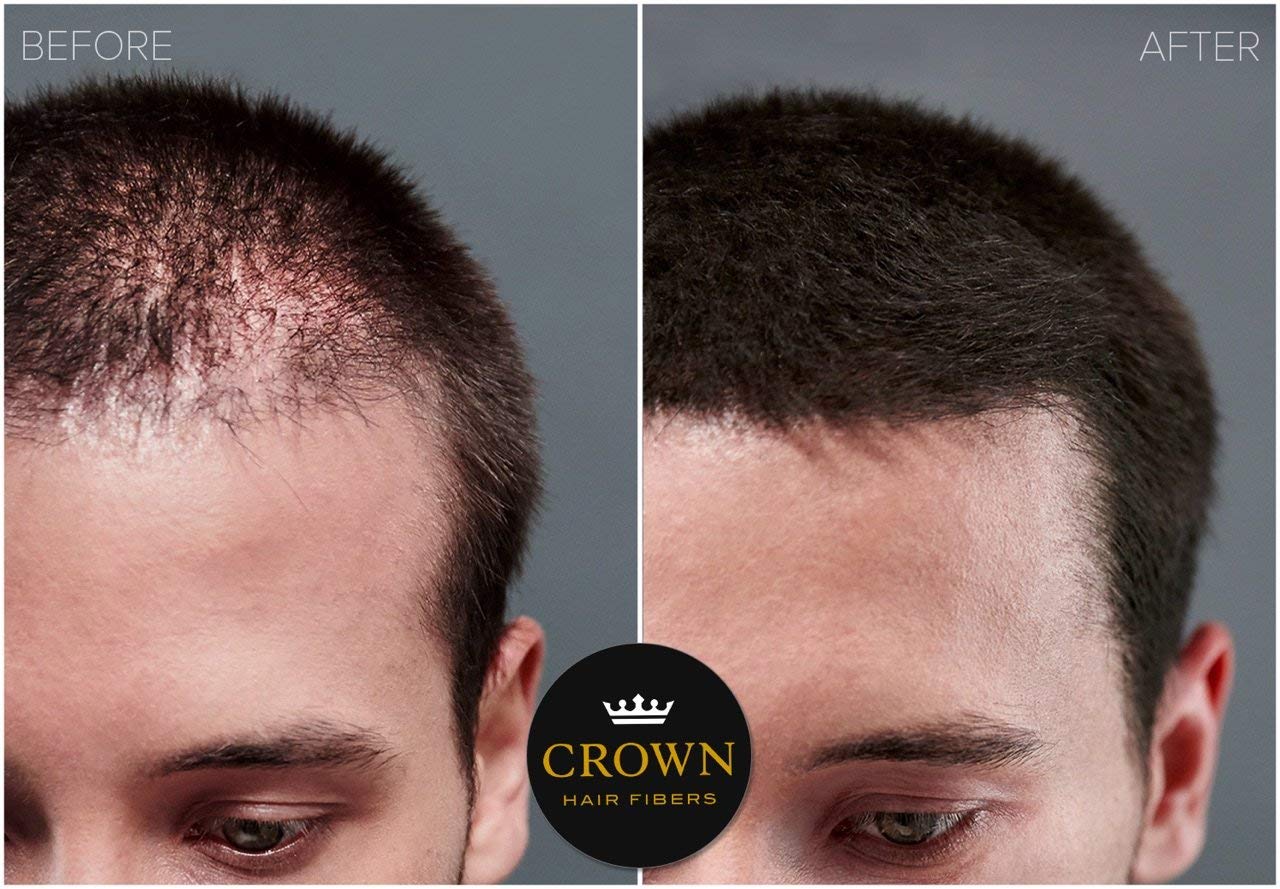 para cabello adelgazante (GRAY)  Espesa instantáneamente el cabello adelgazante o calvo para hombres y mujeres  Botella de 0.87 oz25 g  El mejor