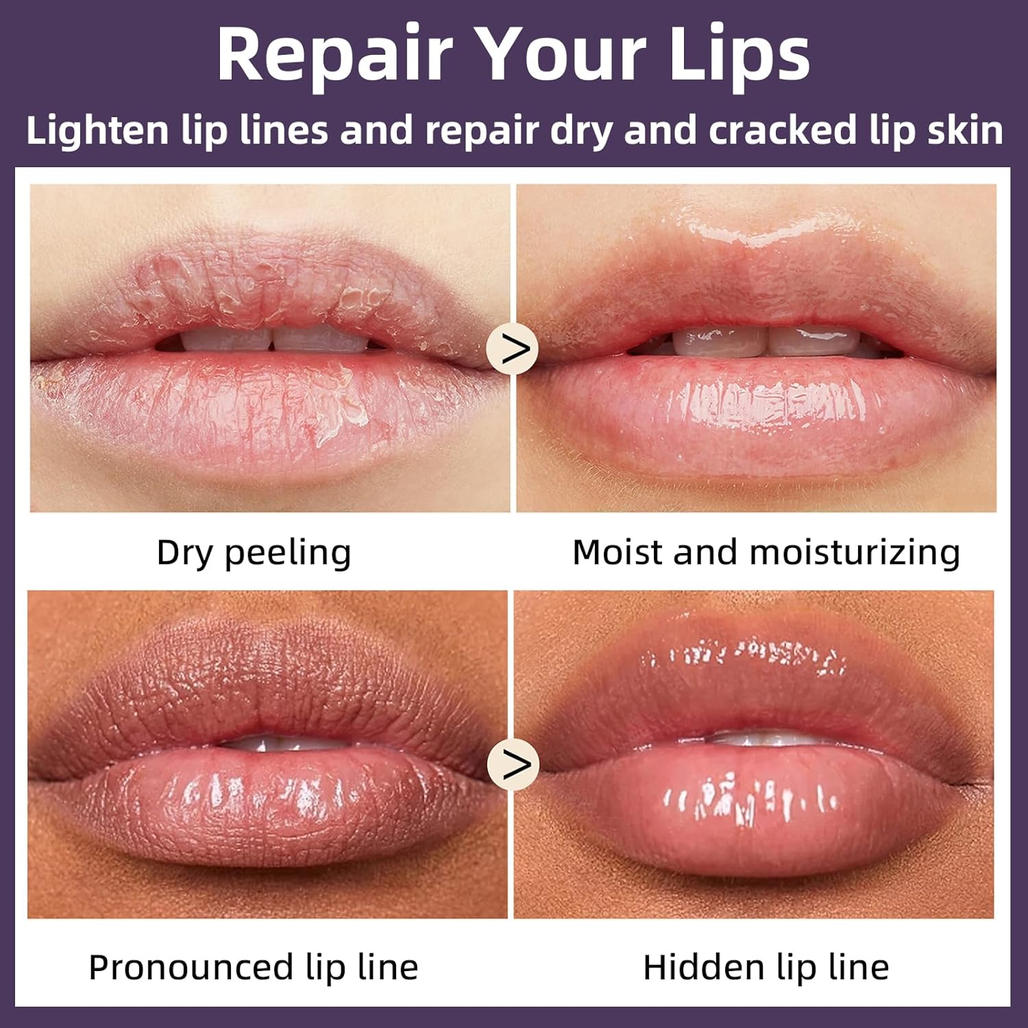 2 unidades de bálsamo de abejas bálsamo labial Honey Pot, miel y calabaza día y noche reparador de labios para dormir, hidratante prevención