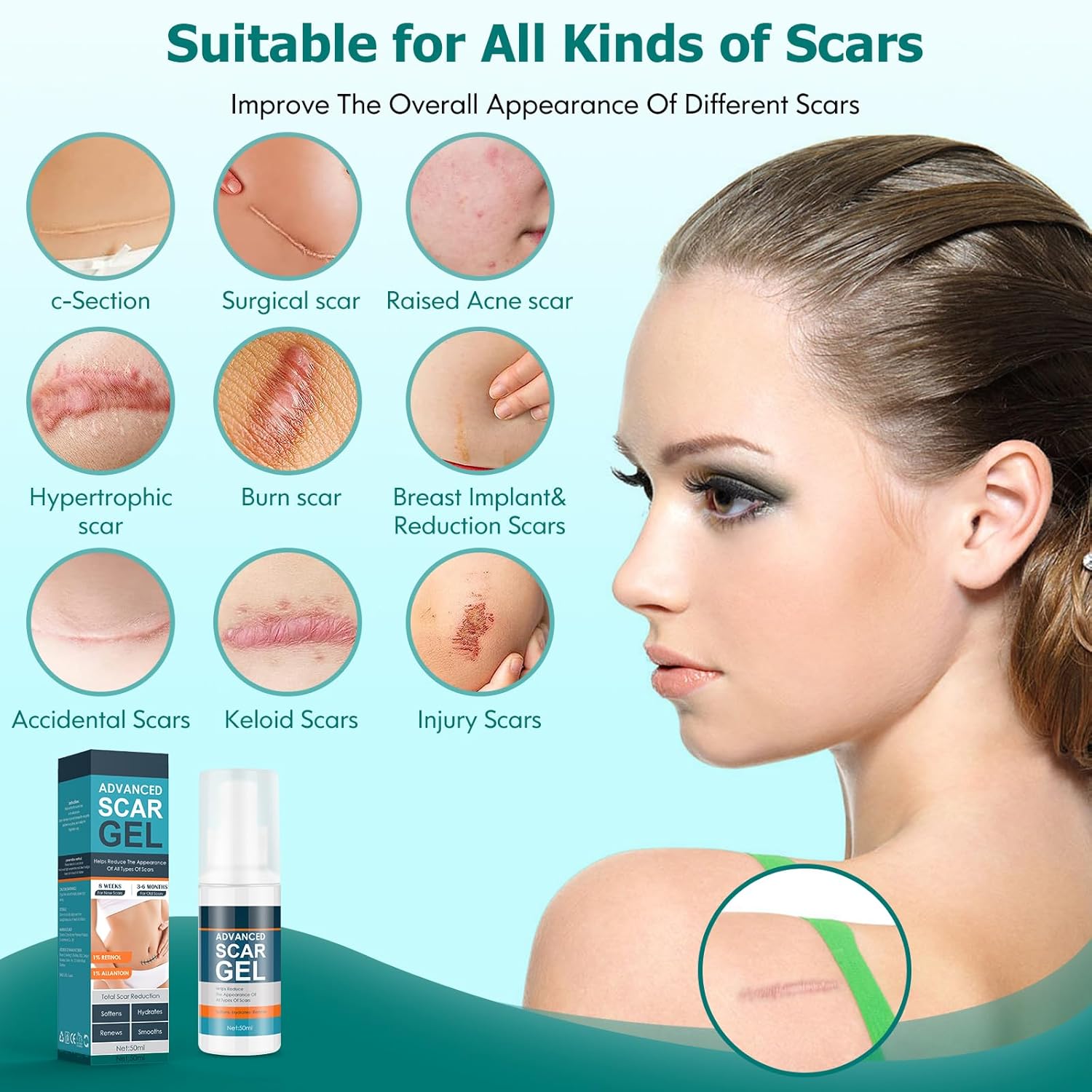 Gel de cicatrices, crema para cicatrices, gel avanzado para cicatrices quirúrgicas, cara, cuerpo, pierna, quemaduras, aceno, cesárea, estrías,