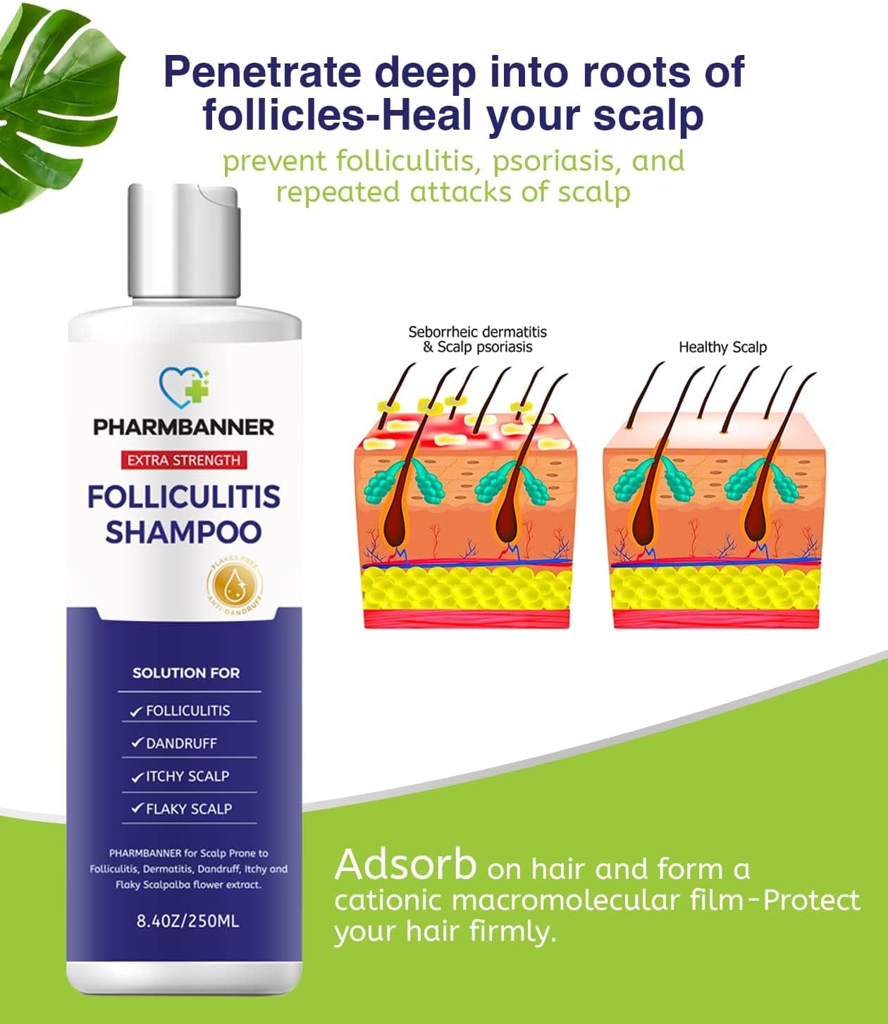 2 piezas de foliculitis, champú para dermatitis seborreica, champú anticaspaantifúngico, tratamiento de foliculitiscaspa, tratamiento de psoriasis