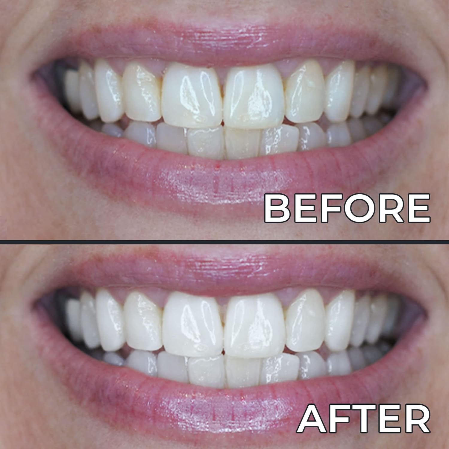 PerioSciences Sistema de blanqueamiento dental  LED Dispositivo de luz de blanqueamiento dental inalámbrico  3 dientes blanqueamiento de gel pluma
