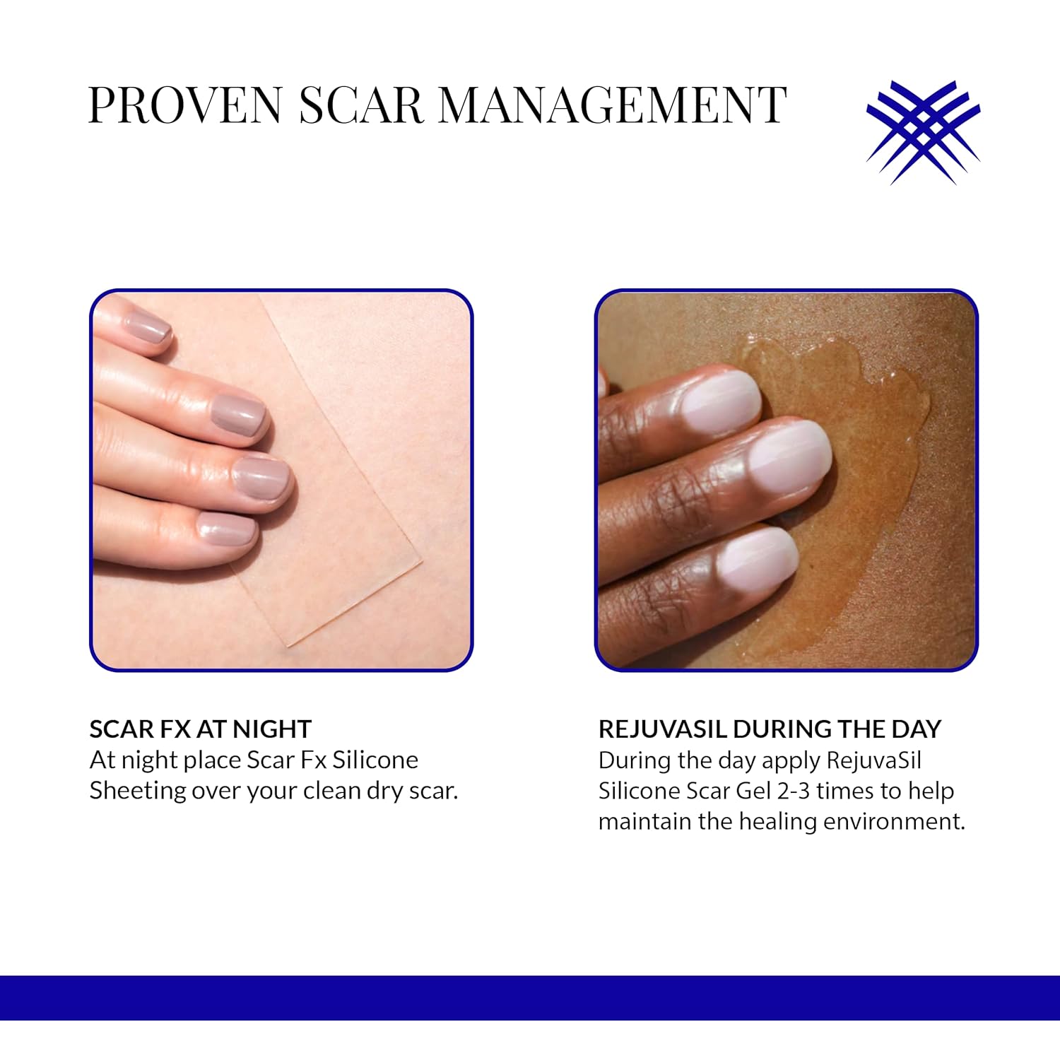 Rejuvaskin Scar Fx – Lámina de silicona, cinta de silicona de 1 x 22 pulgadas para cicatrices abdominales, 1 hoja, suaviza, aplanar y reducir la