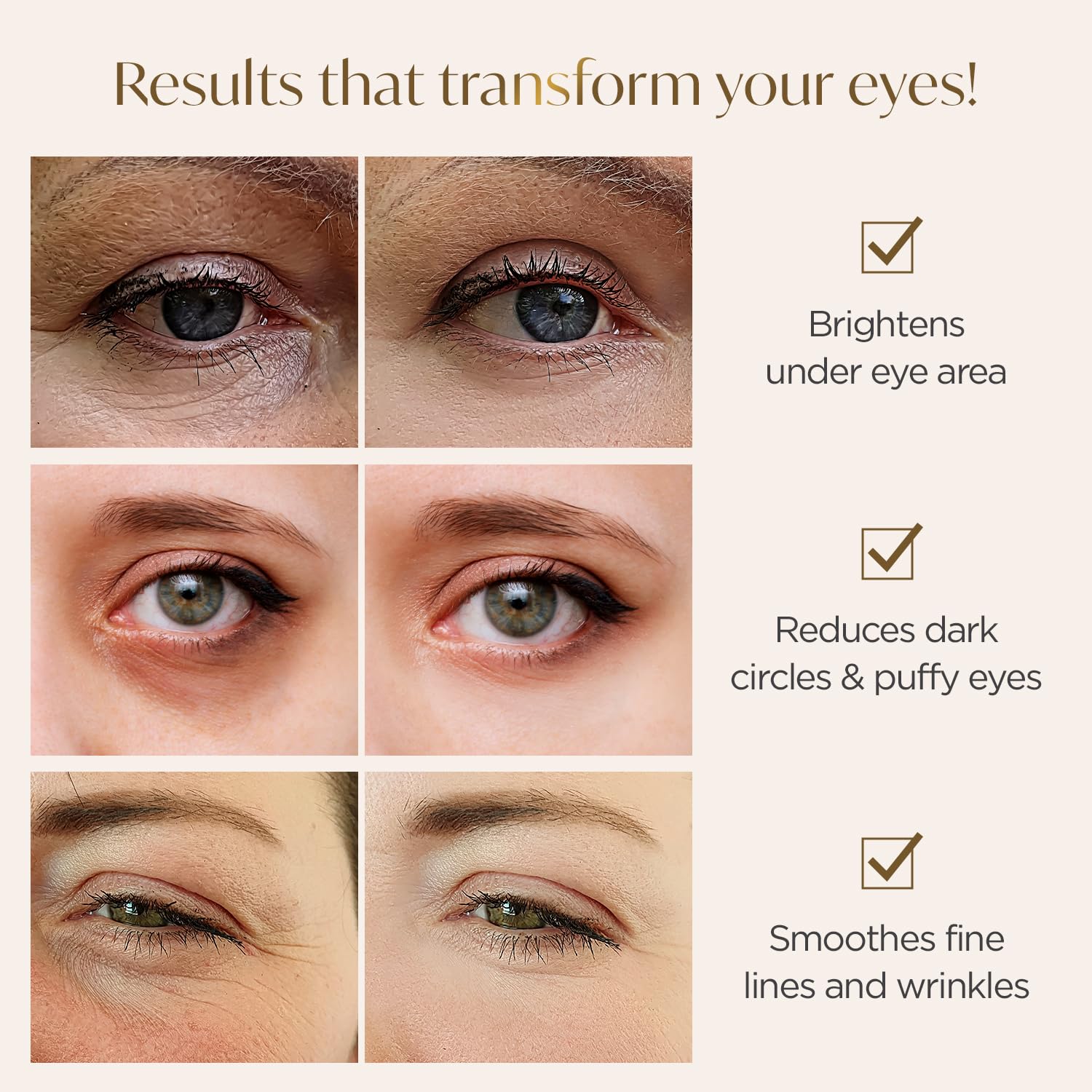 PLANTIFIQUE Parches dorados para ojos hinchados y ojeras, 20 pares de máscaras debajo de los ojos para ojeras e hinchazón, geles de ojos con