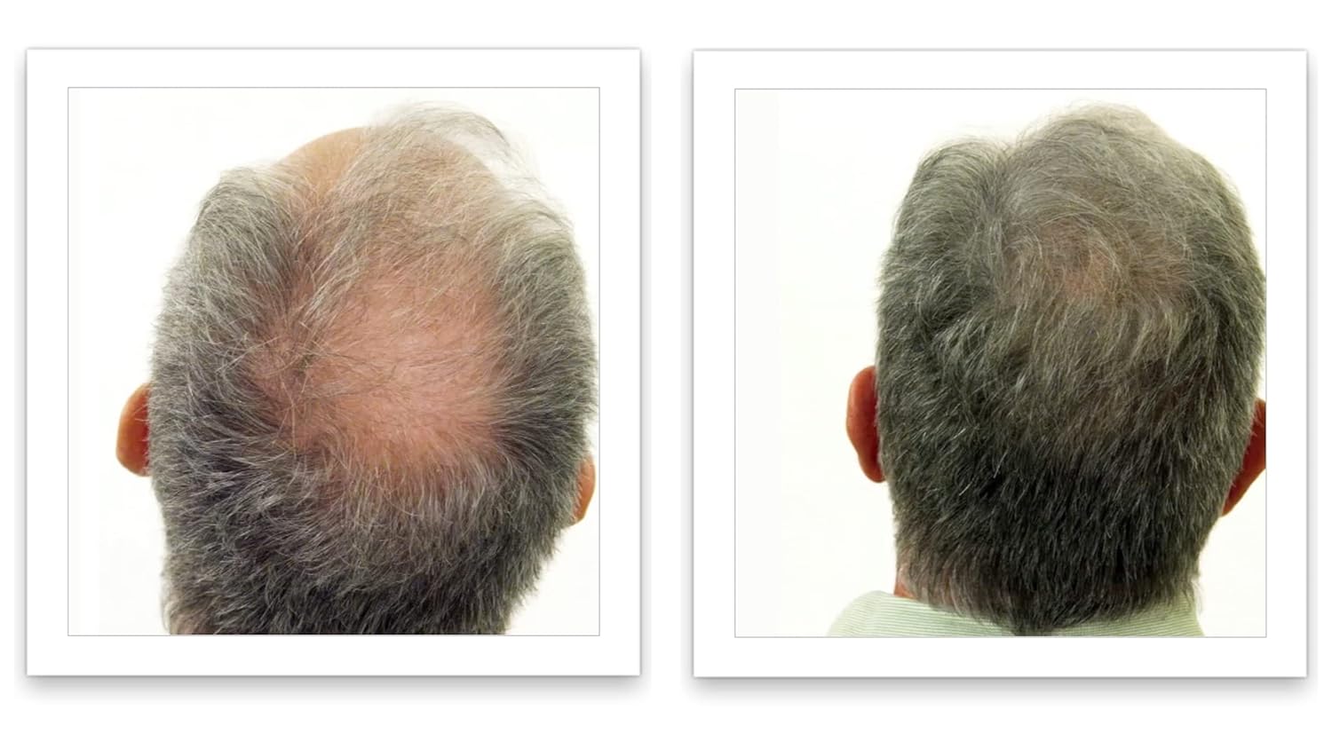Tamaño de prueba haz que el cabello fino se vea 10 veces más lleno. Elimina el punto calvo y el adelgazamiento del cabello al instante. Corrector de