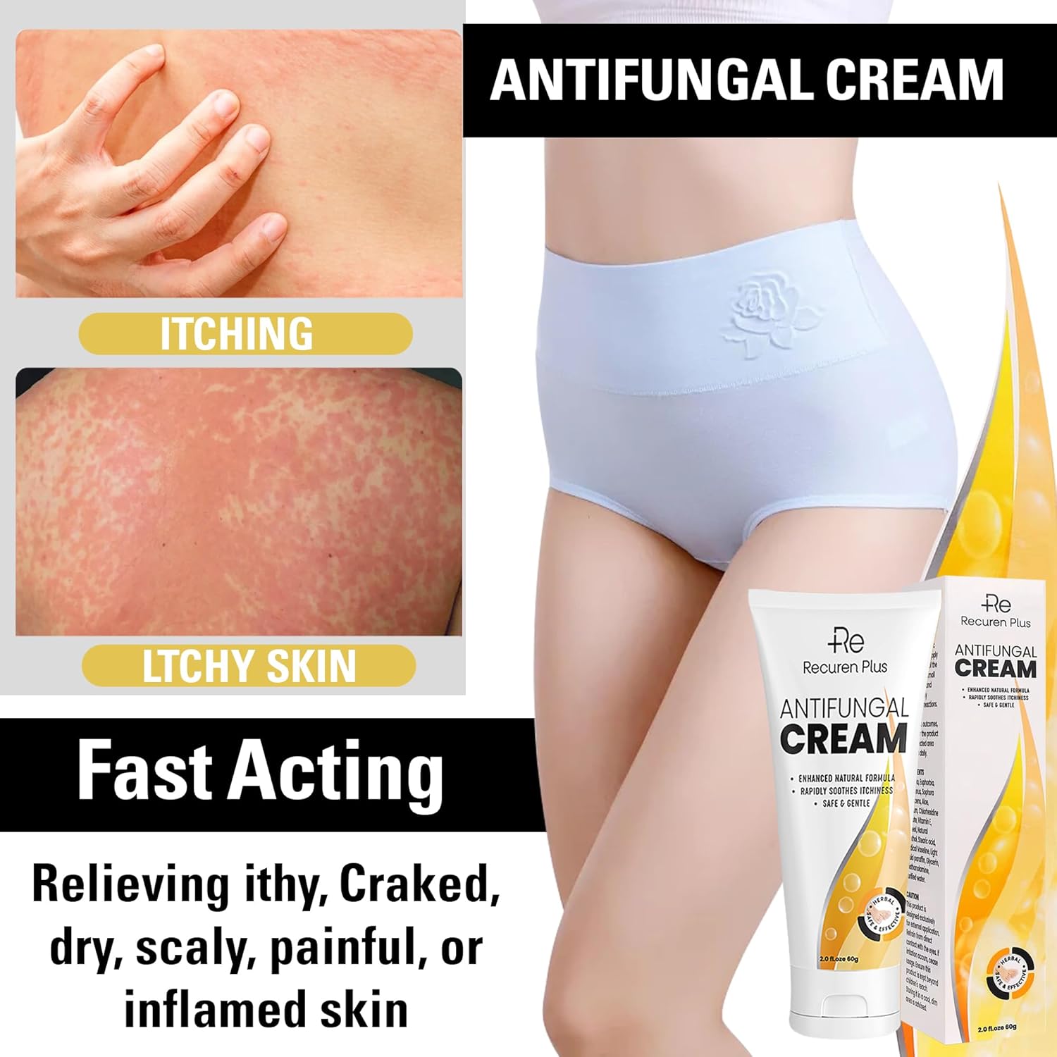 Crema antifúngica Tratamiento de pies de atletas – Tratamiento Versicolor de tiña – Crema de comezón jock – Tratamiento de pies de atletas extra