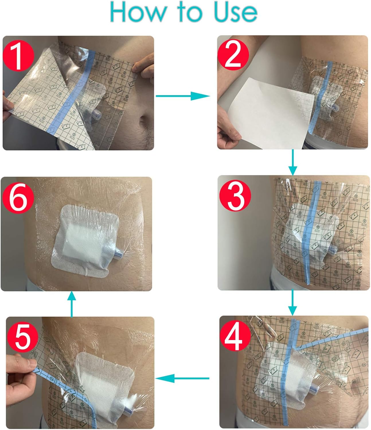 Cubierta de ducha impermeable para puerto de diálisis, vendaje adhesivo transparente para quimioterapia PD tubo de alimentación de clavijas