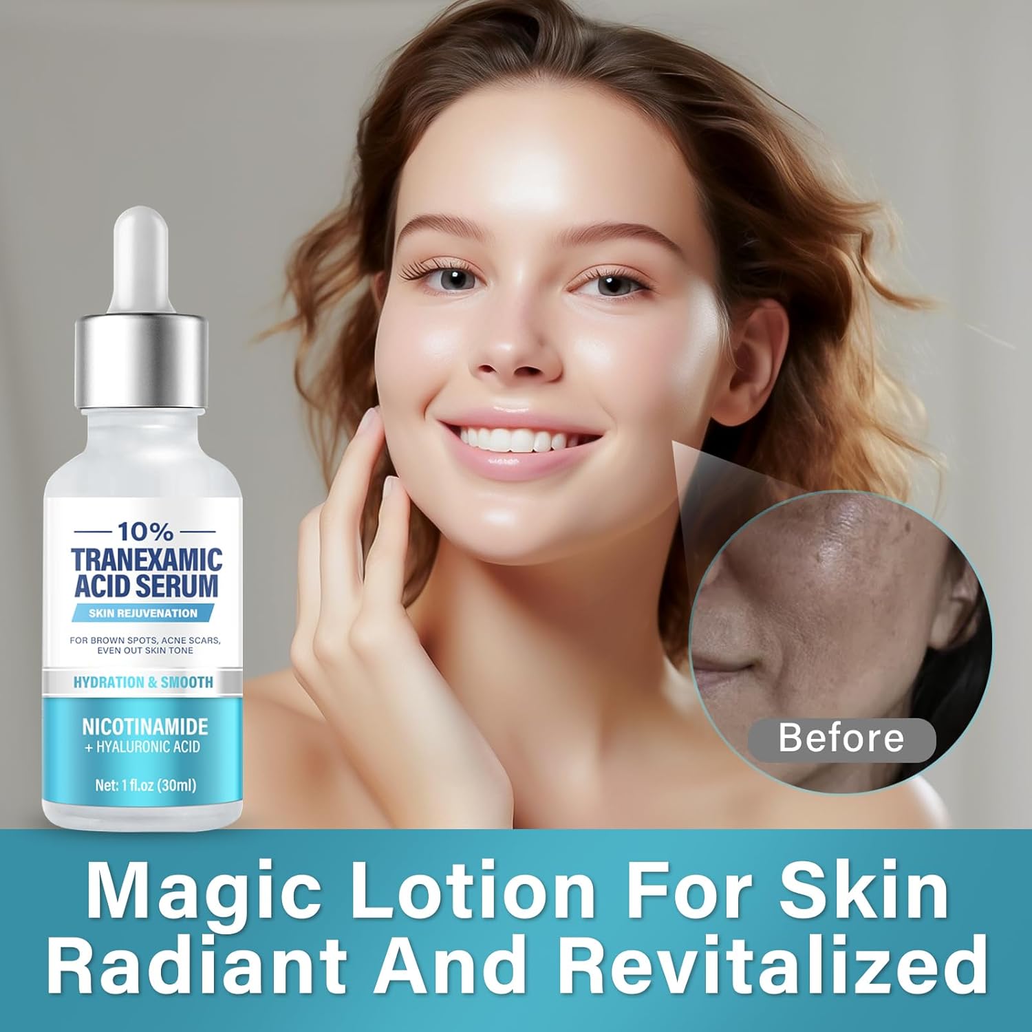 Suero 10% de ácido tranexamíc, suero corrector de decoloración, removedor natural de manchas oscuras para cara, ácido hialurónico y niacinamida