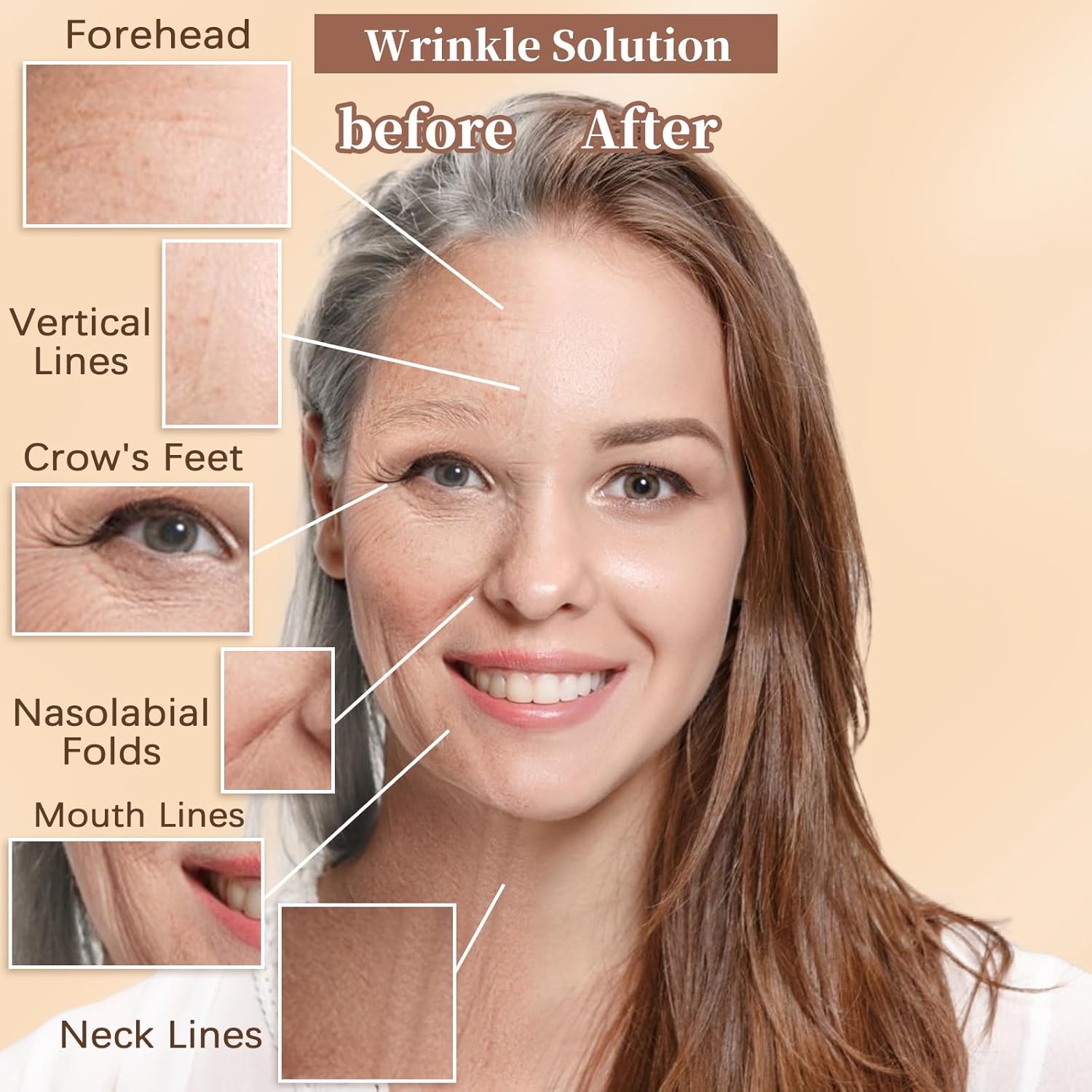 3 rollos de cinta de estiramiento facial instantáneo, parche miofascial facial para tratamiento de arrugas para línea V, levantamiento de piel
