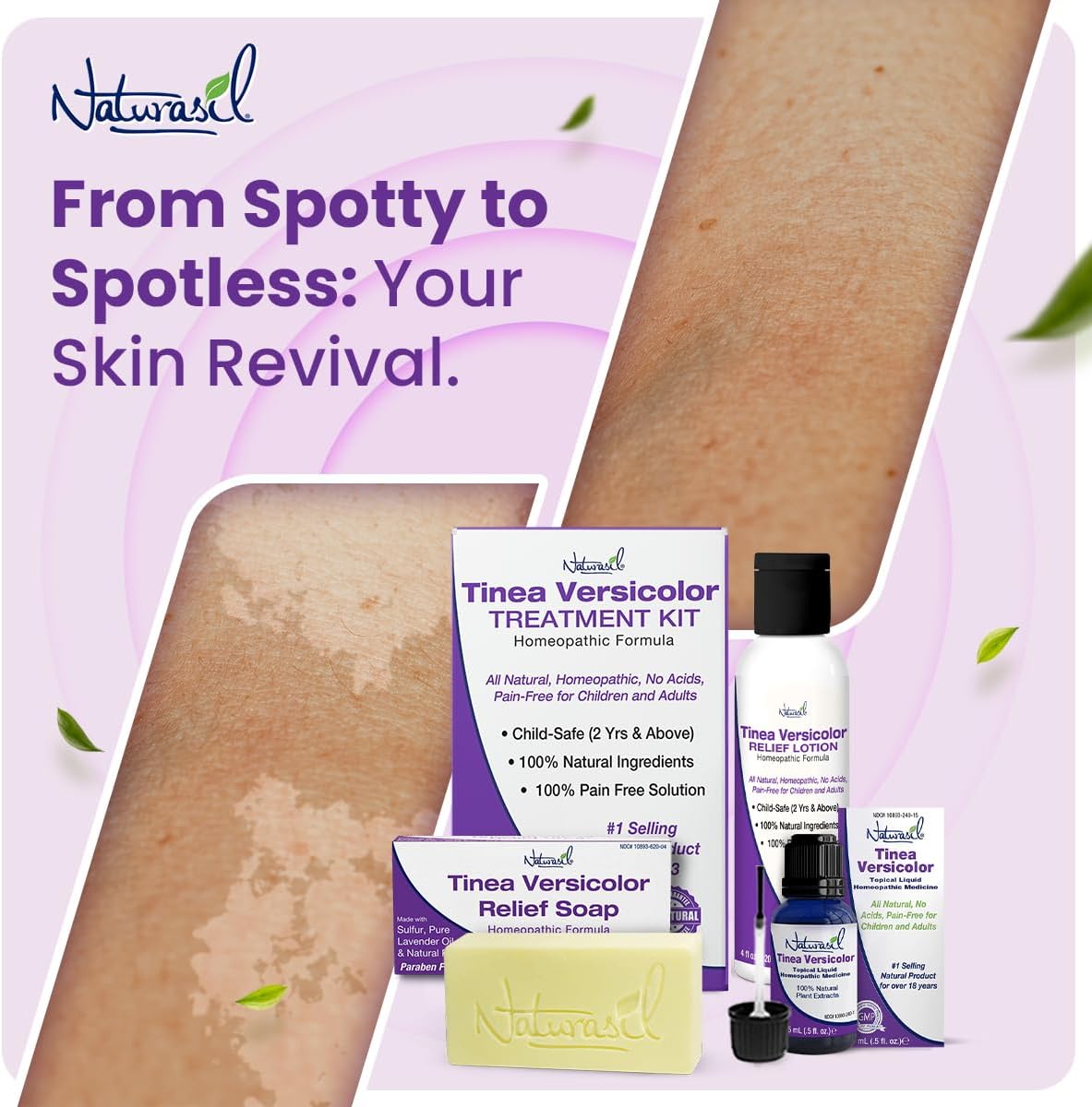 Naturasil Natural Treatment Tinea Versicolor - Jabón 10 de azufre También ayuda a aliviar la candida y la onicomicosis Barra de 4 onzas Paquete - Imagen 5