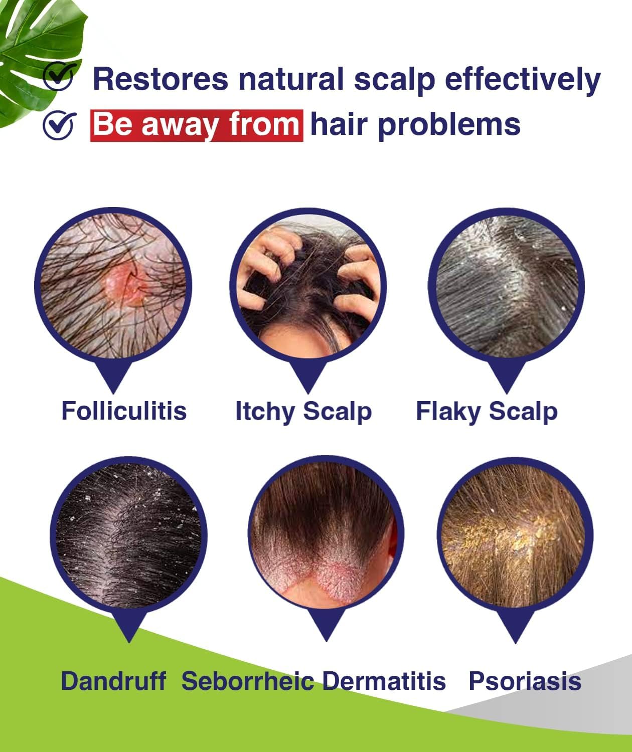 2 piezas de foliculitis, champú para dermatitis seborreica, champú anticaspaantifúngico, tratamiento de foliculitiscaspa, tratamiento de psoriasis